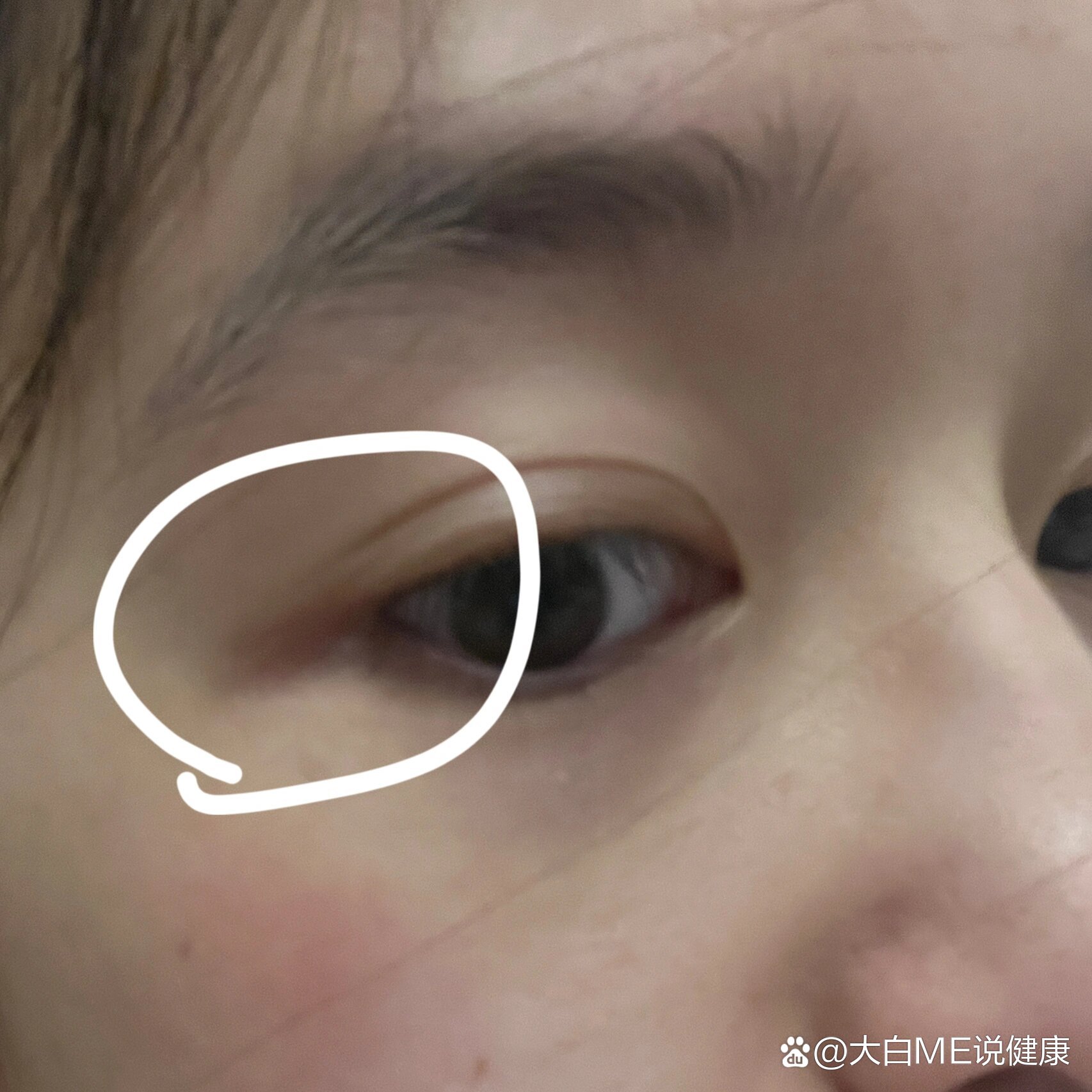 原来它叫眼尾沟!