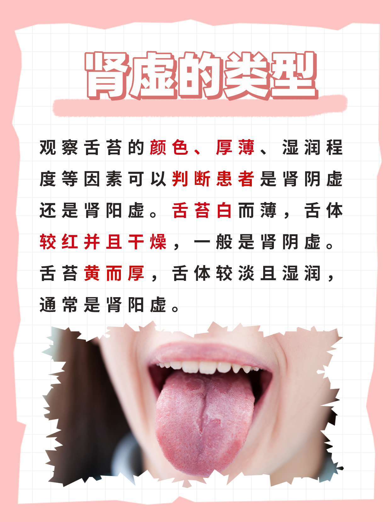 看舌苔，轻松辨别肾阴虚与肾阳虚！