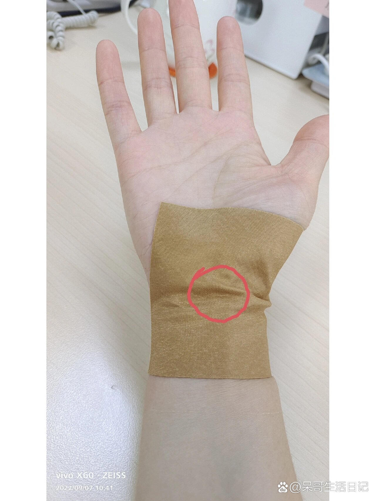 手腕疼,贴膏药好像不管用,这是腱鞘炎吗