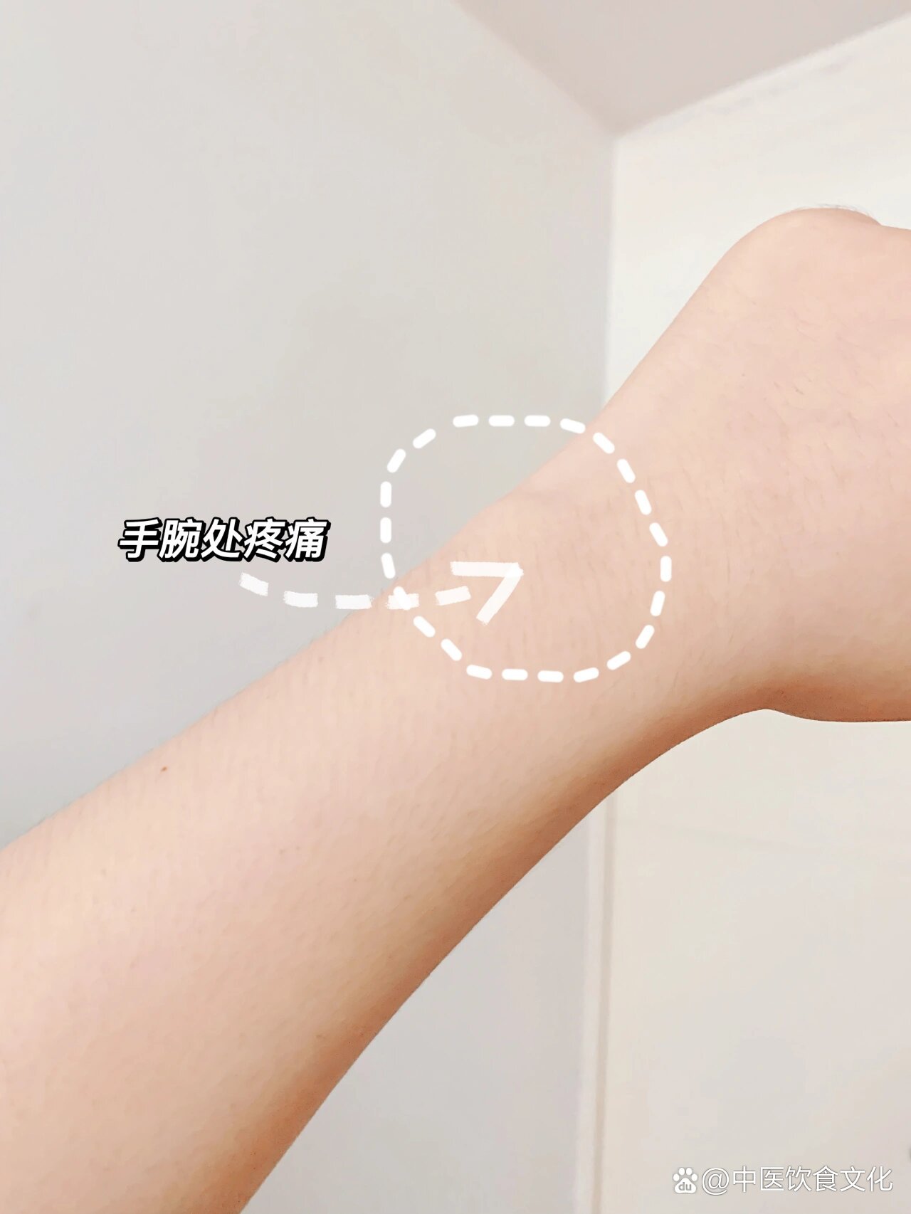 奇正白脉软膏|腱鞘炎有效药膏