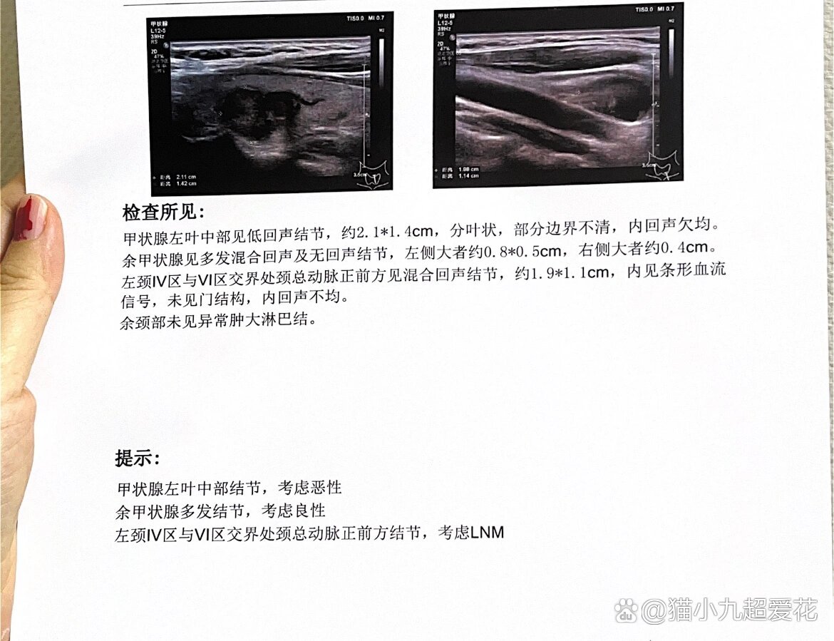 北京肿瘤医院黄牛票贩子挂号号贩子联系方式-的简单介绍