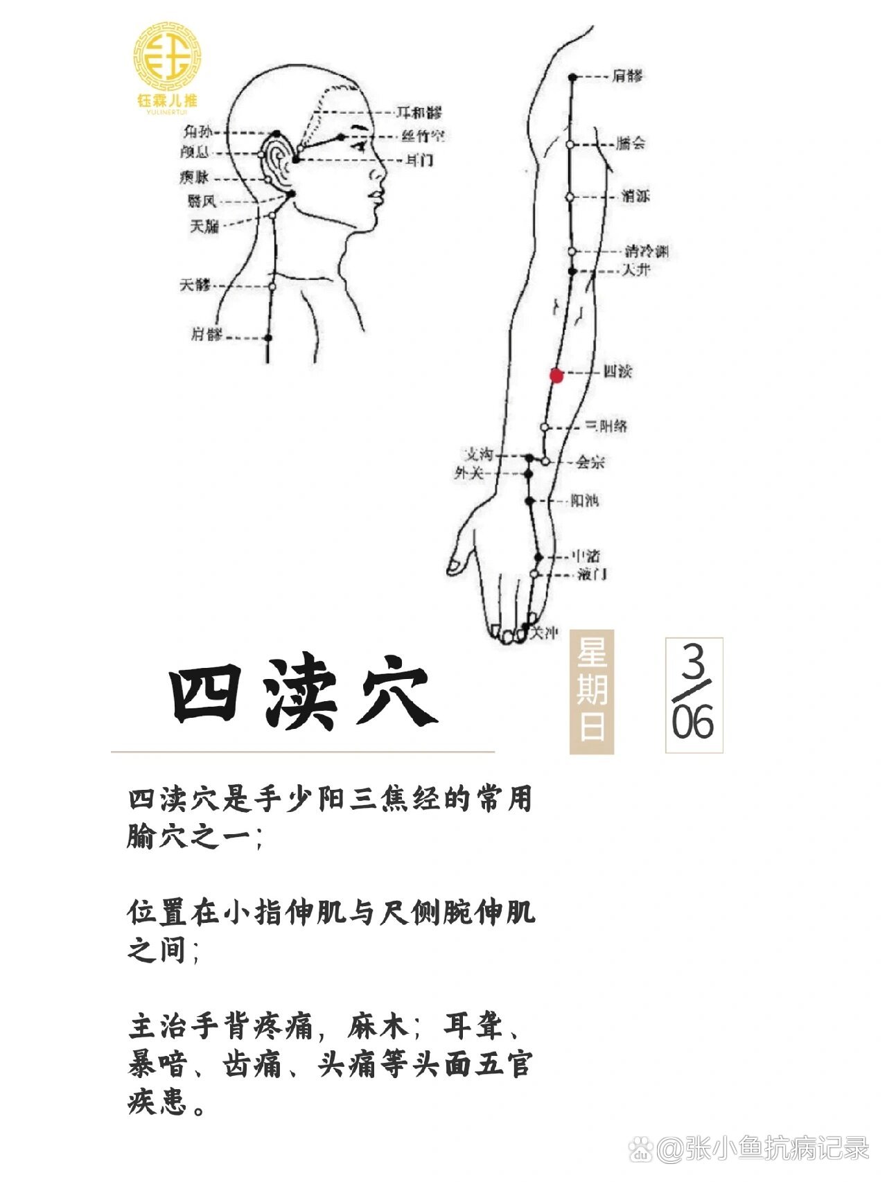 手麻贴膏药位置图解图片