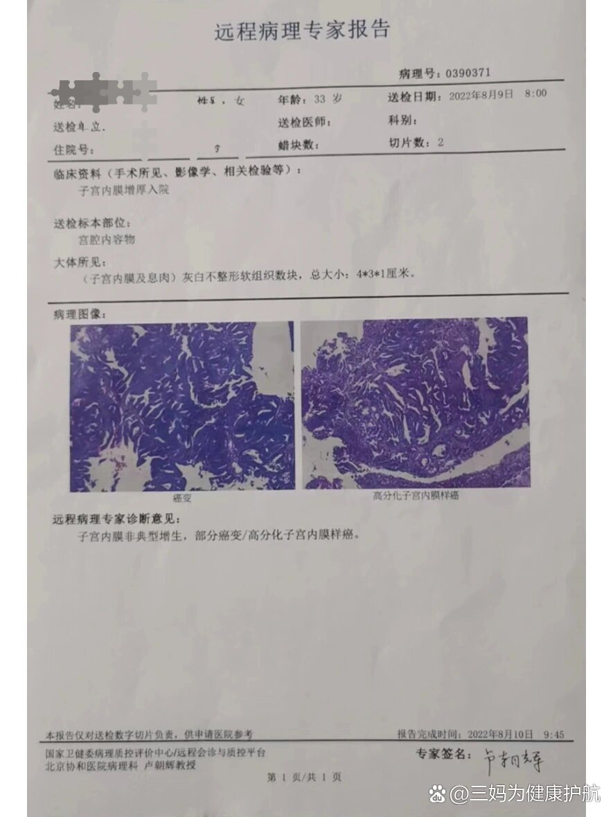 子宫内膜癌诊刮物图片图片