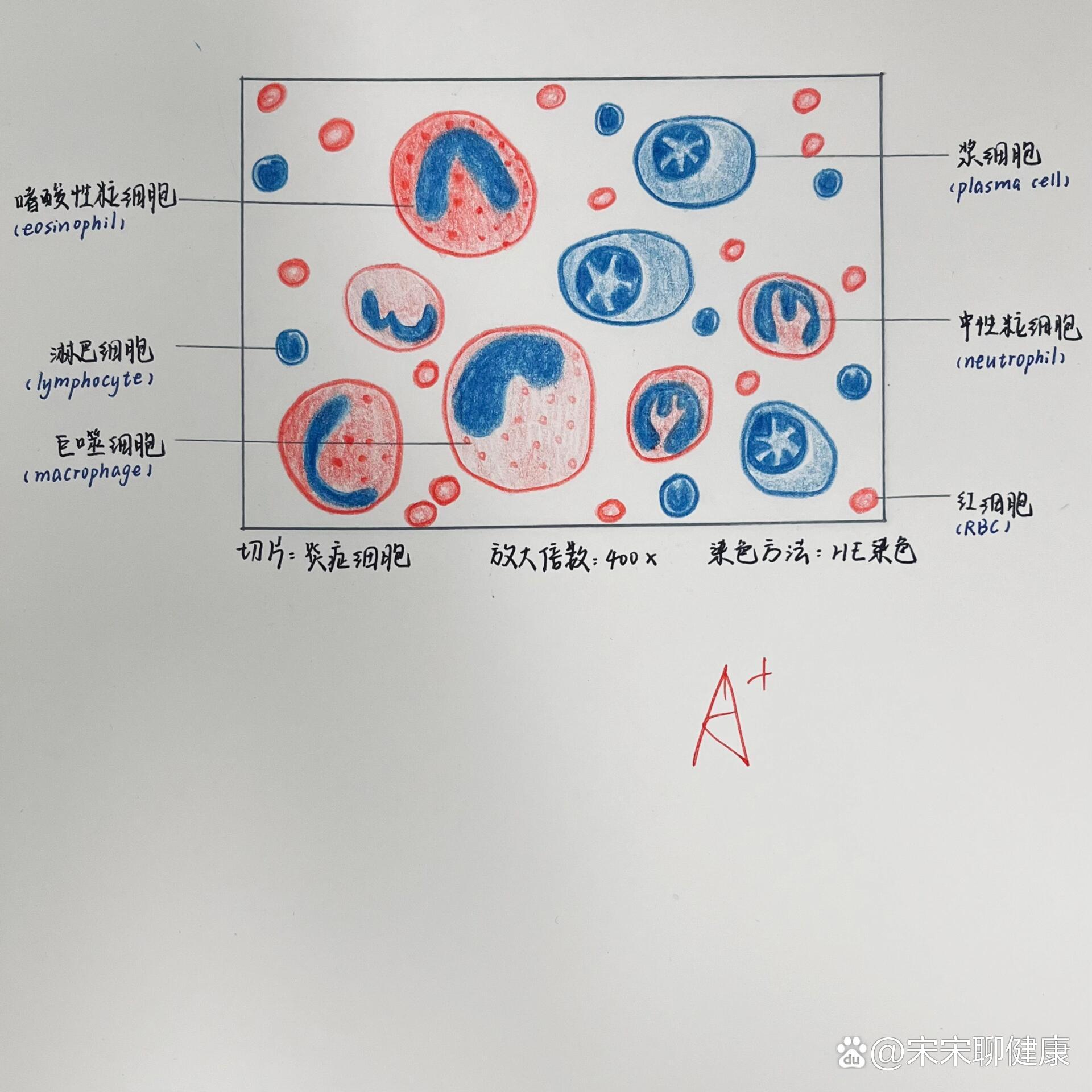 晚幼红细胞红蓝铅笔图图片