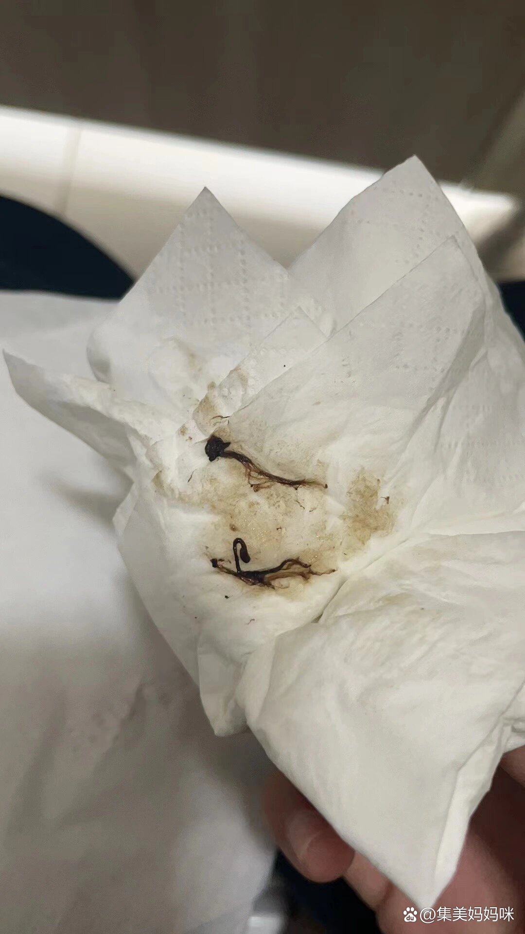 试管08移植第8天,流褐色分泌物