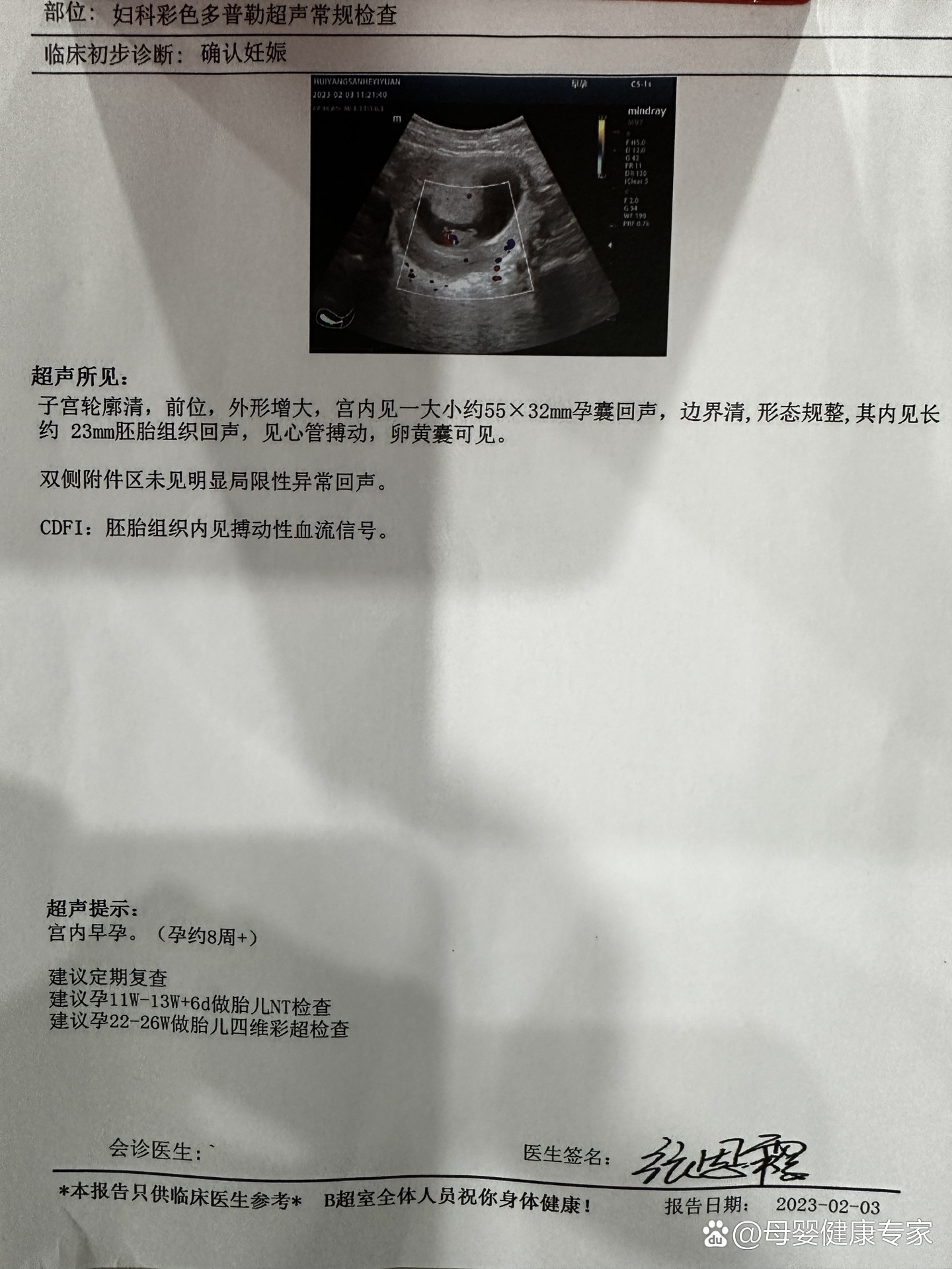 8周胎心胎芽