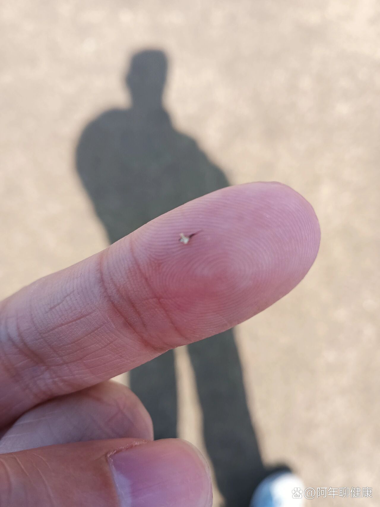 蜜蜂蛰了一下我的脖子,这是它的刺.