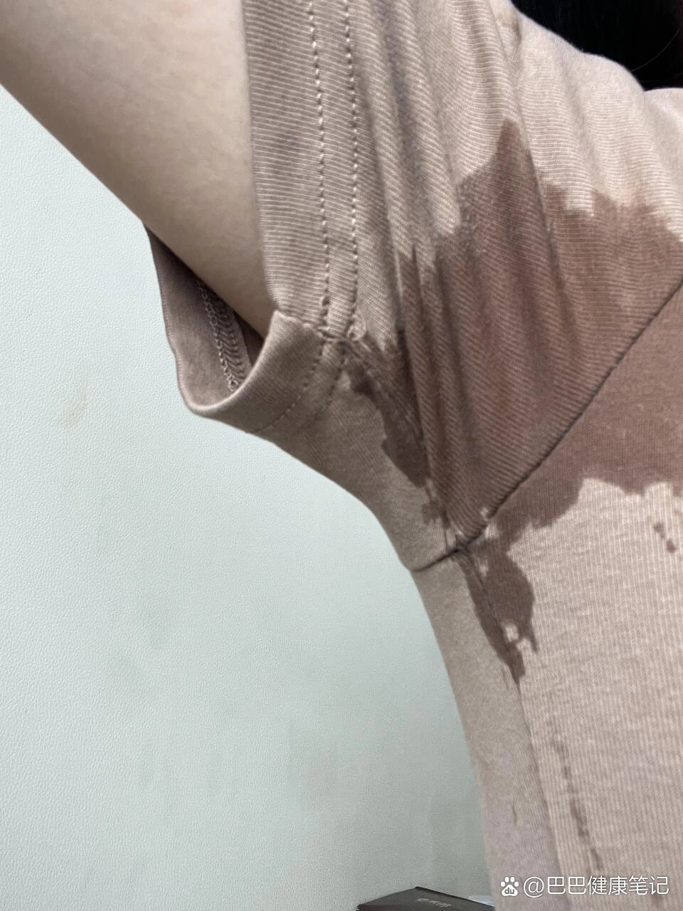 为什么腋下老是出汗