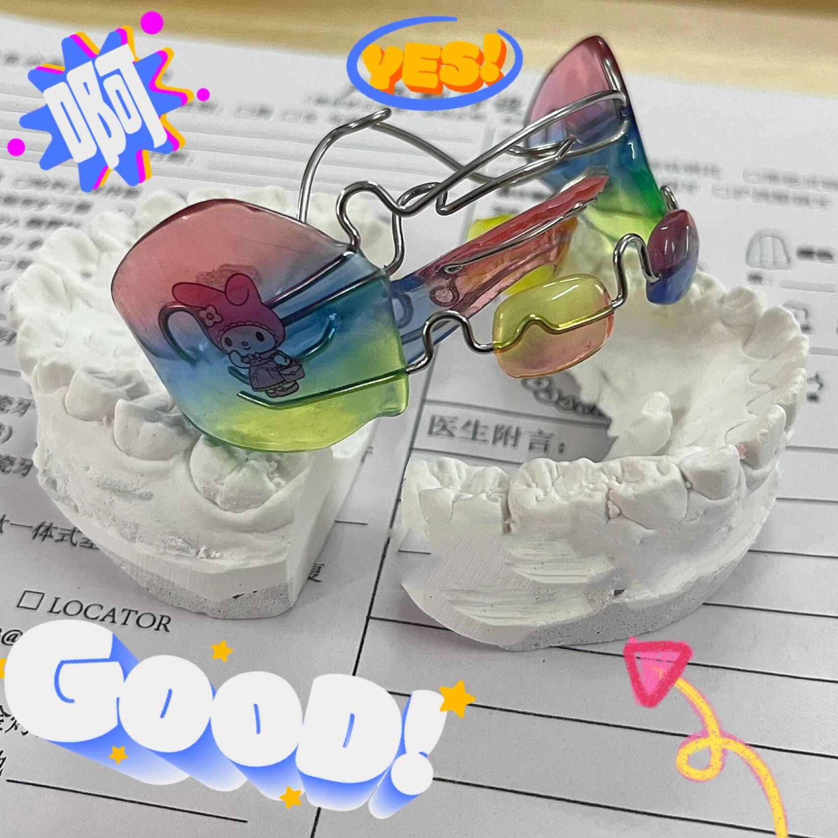 法兰克2功能矫治器frank