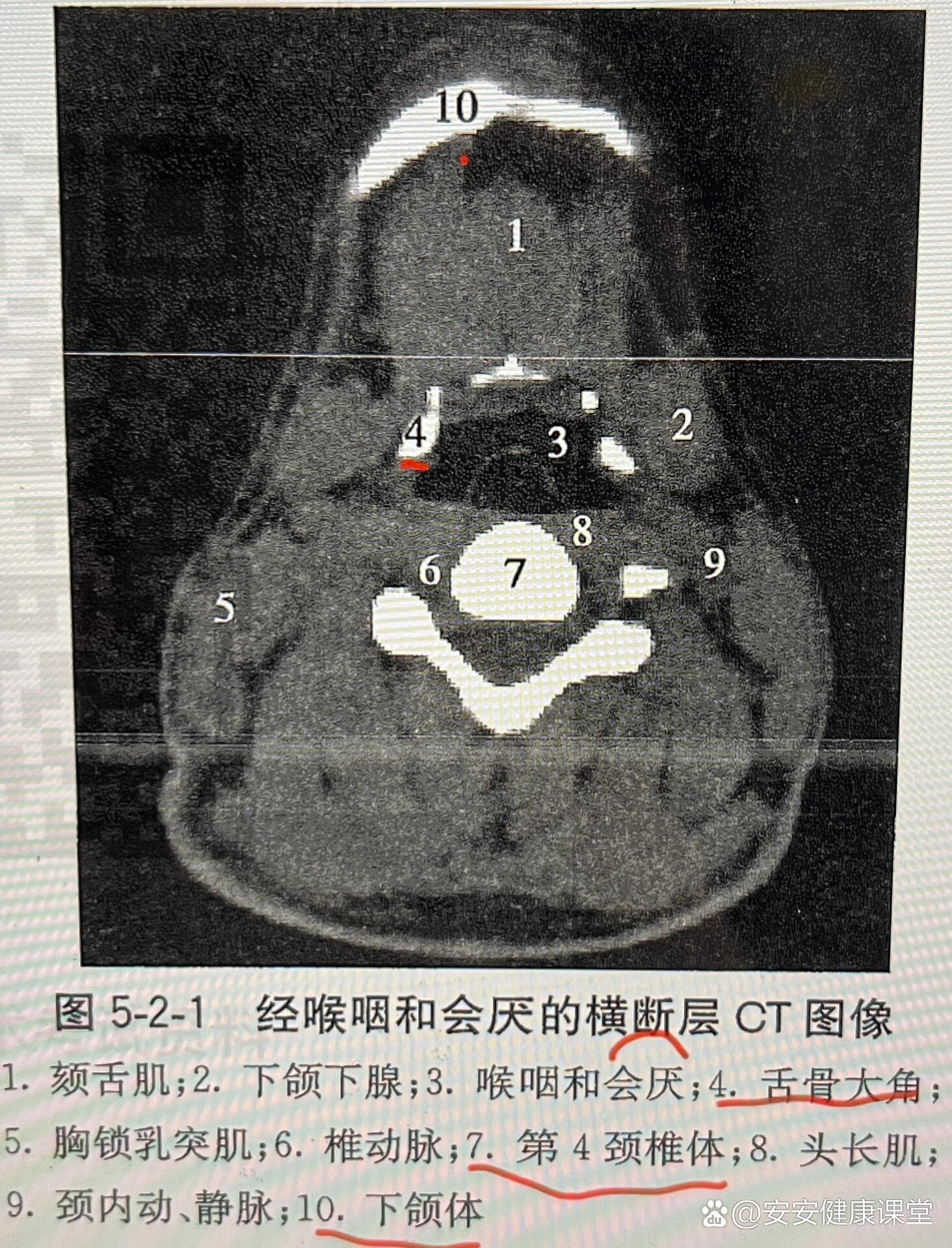 判断断层的标志图片