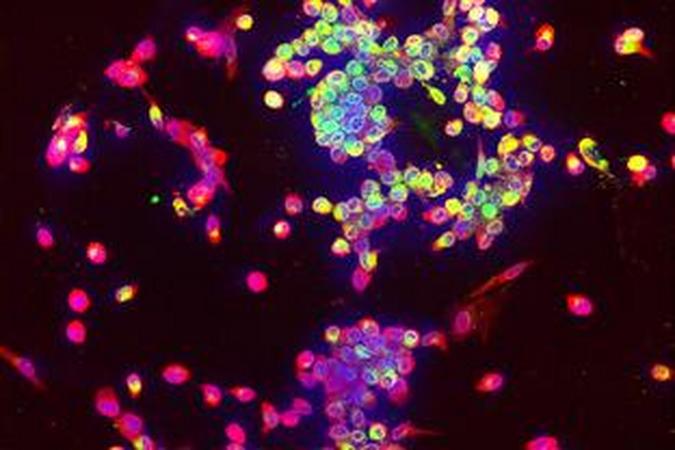 免疫荧光实验操作流程及注意事项