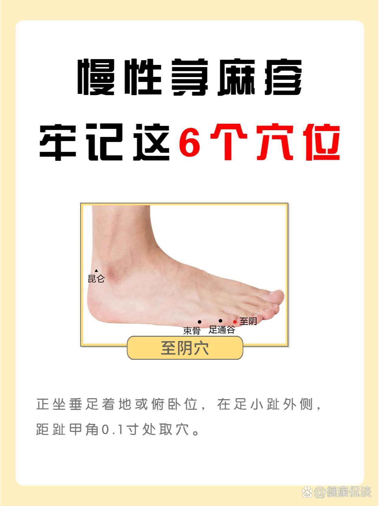 多按这6大穴位慢性荨麻疹一天比一天好