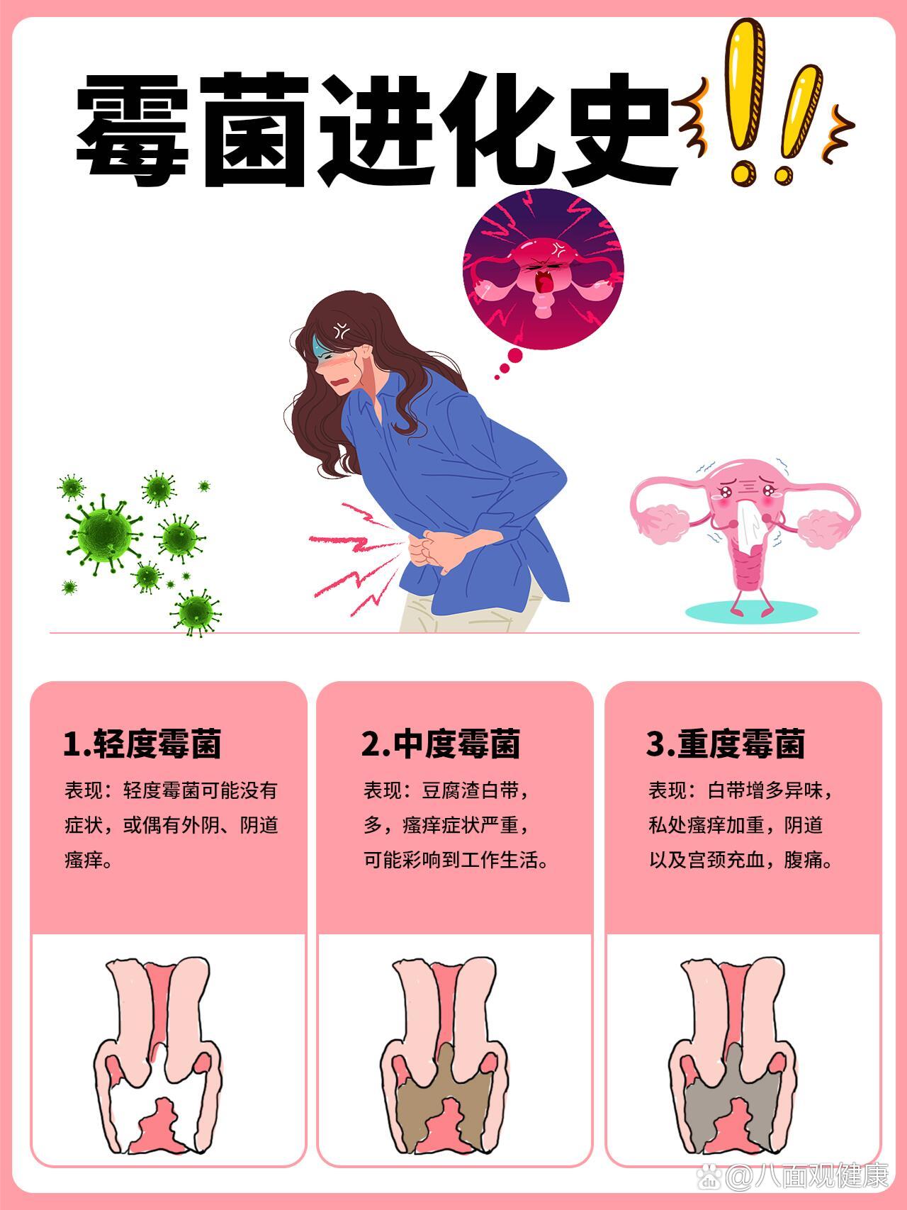 霉菌性阴道炎竟是因为它❗霉菌姐妹速来围观