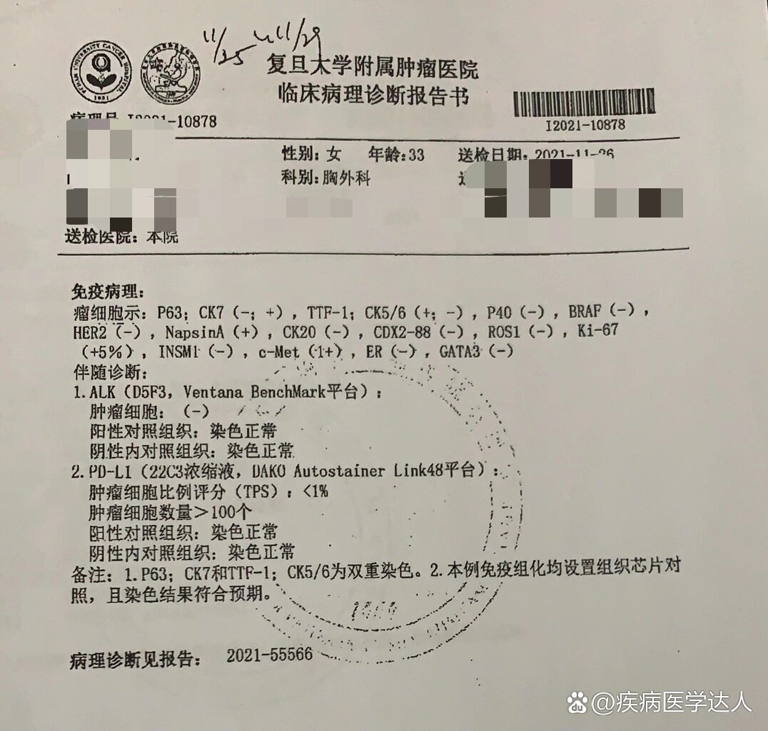 肺结节大病理