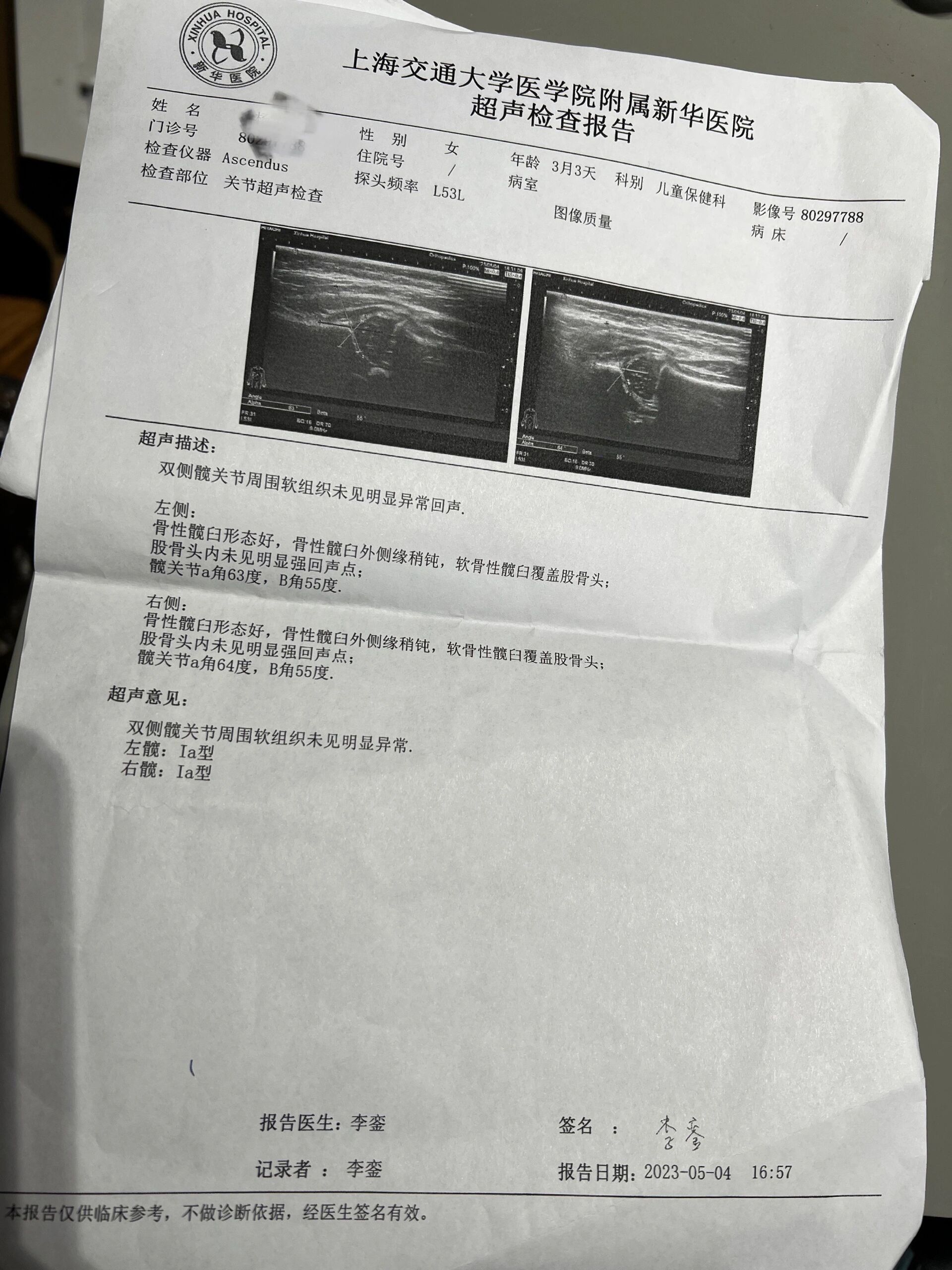 三月龄儿保之髋关节iib翻盘