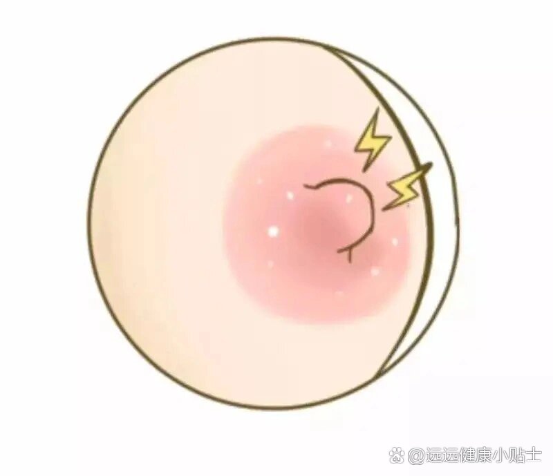 乳房里有小疙瘩图片