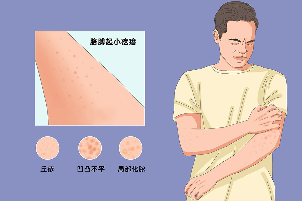 胳膊上渗血似的小点