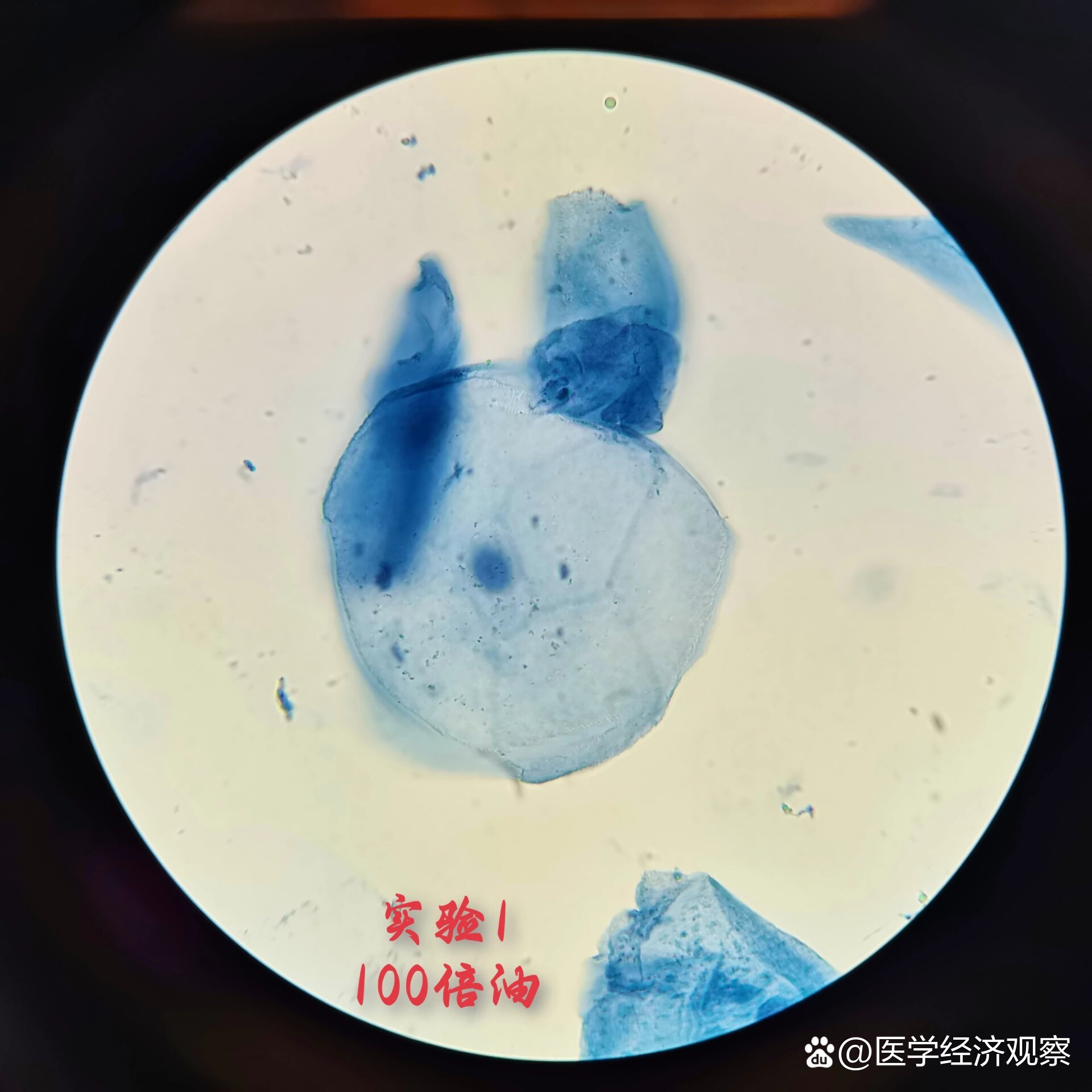 洋葱表皮细胞的线粒体活体观察这次实验一的口腔上皮细胞由本装片