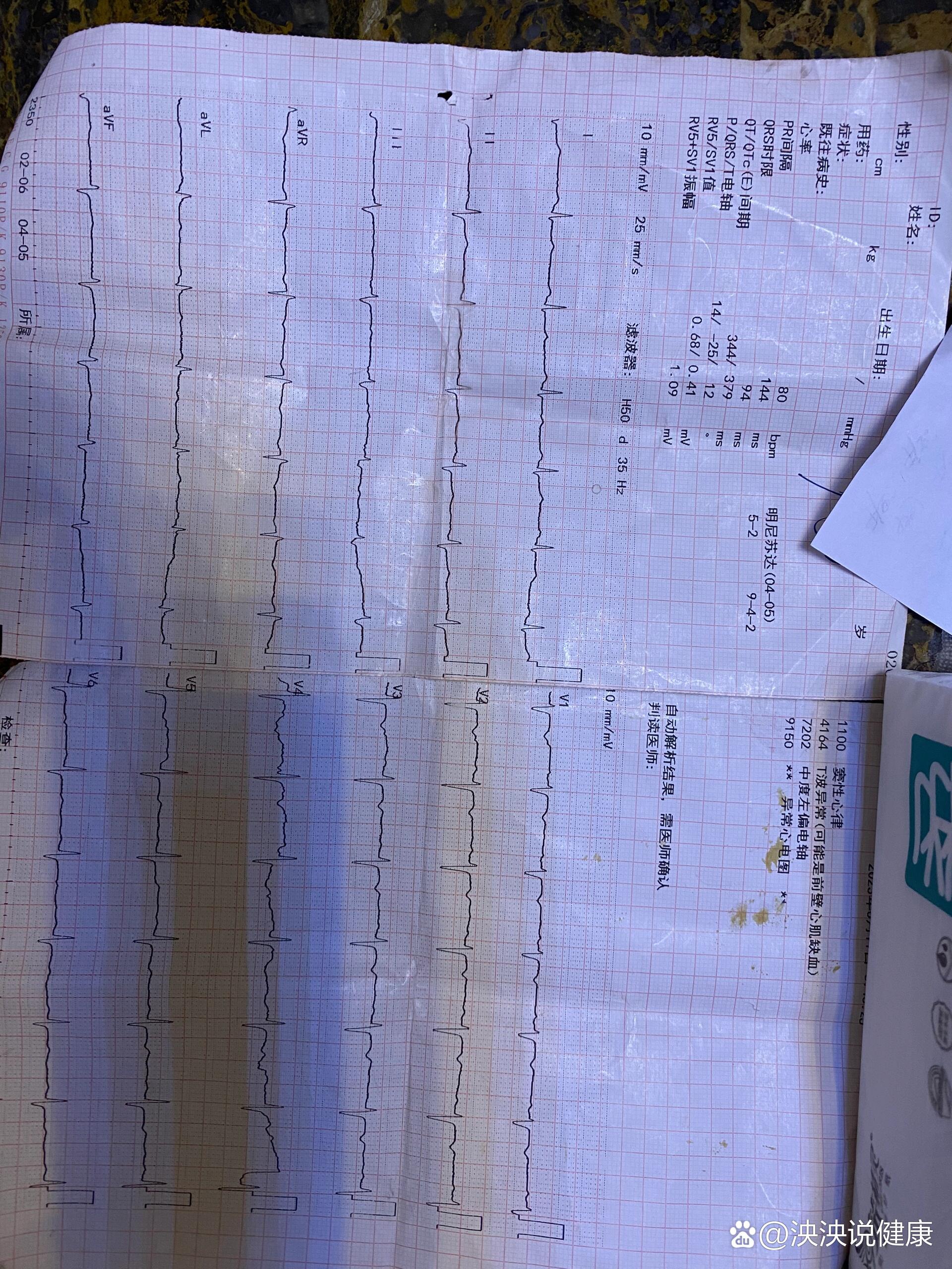 夜里梦到心脏被一根铁钉穿过,就开启了胸闷心悸之旅,各种检查心脏彩超