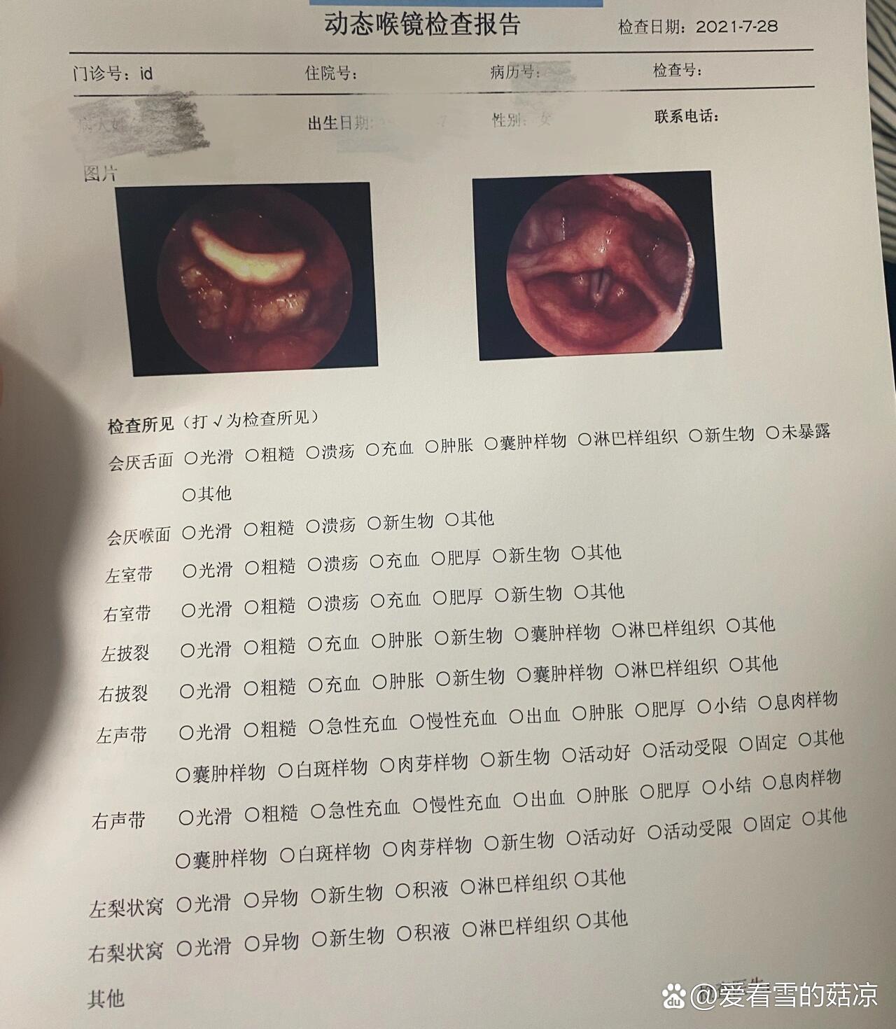 会厌炎喉镜图片图片