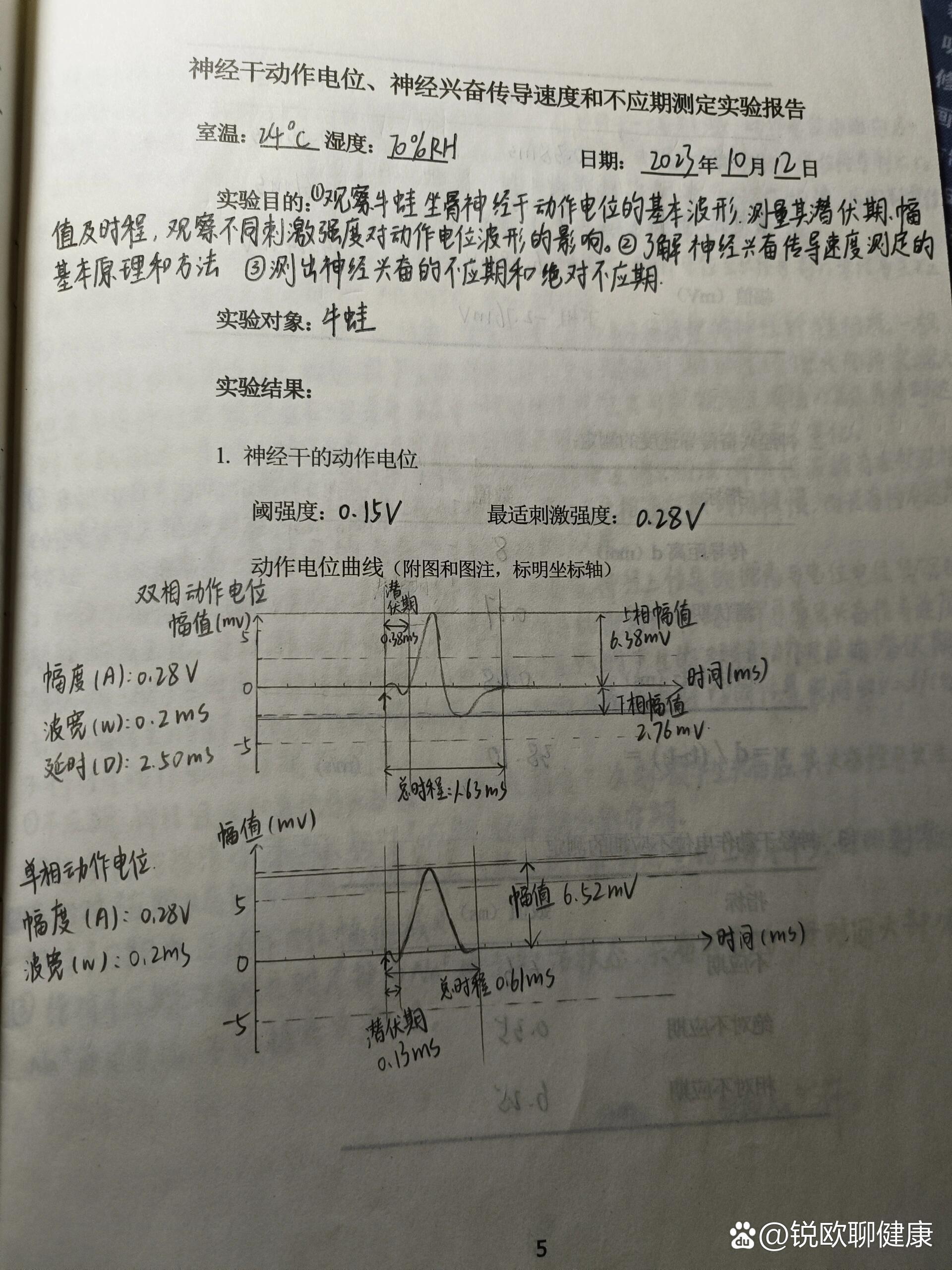 神经传导电位变化图图片