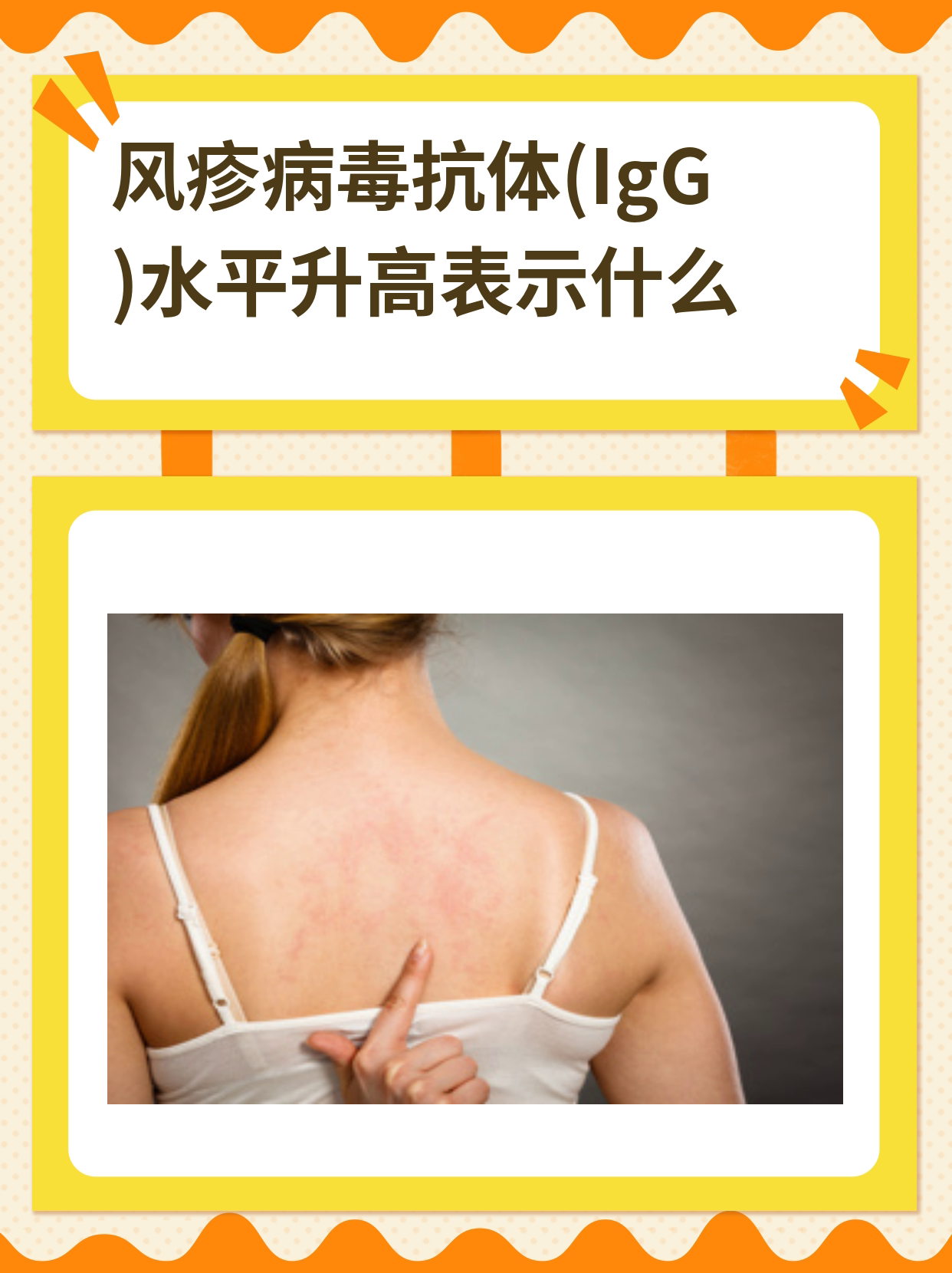 风疹病毒抗体(igg)水平升高表示什么