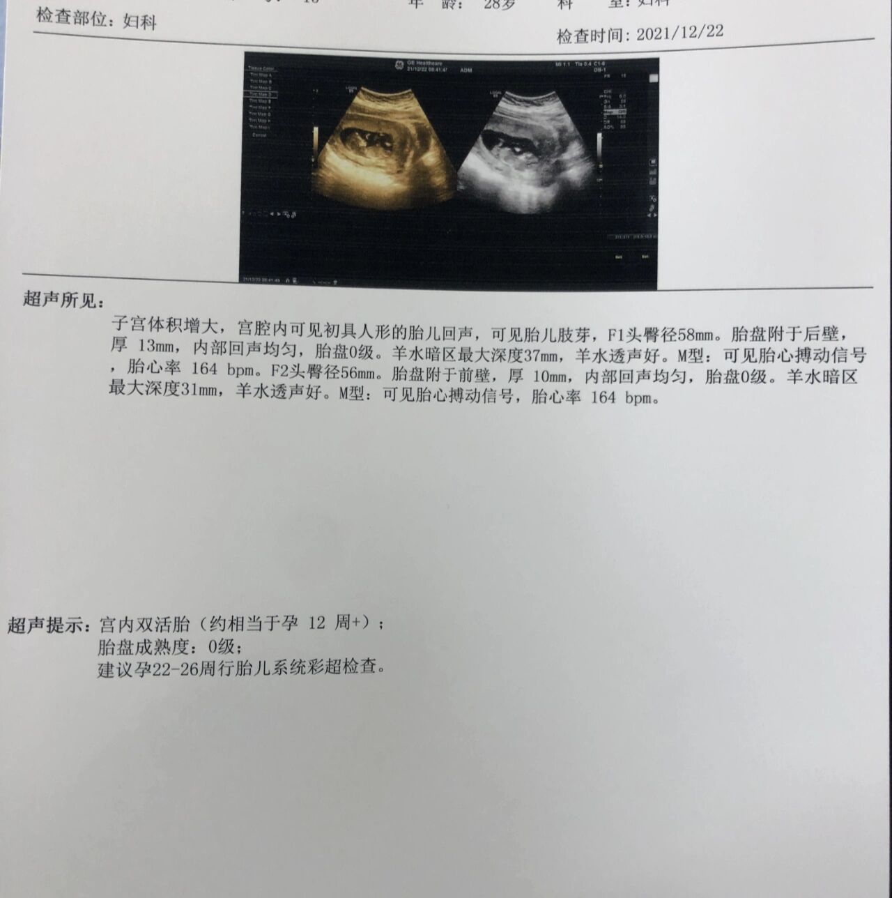 孕12周