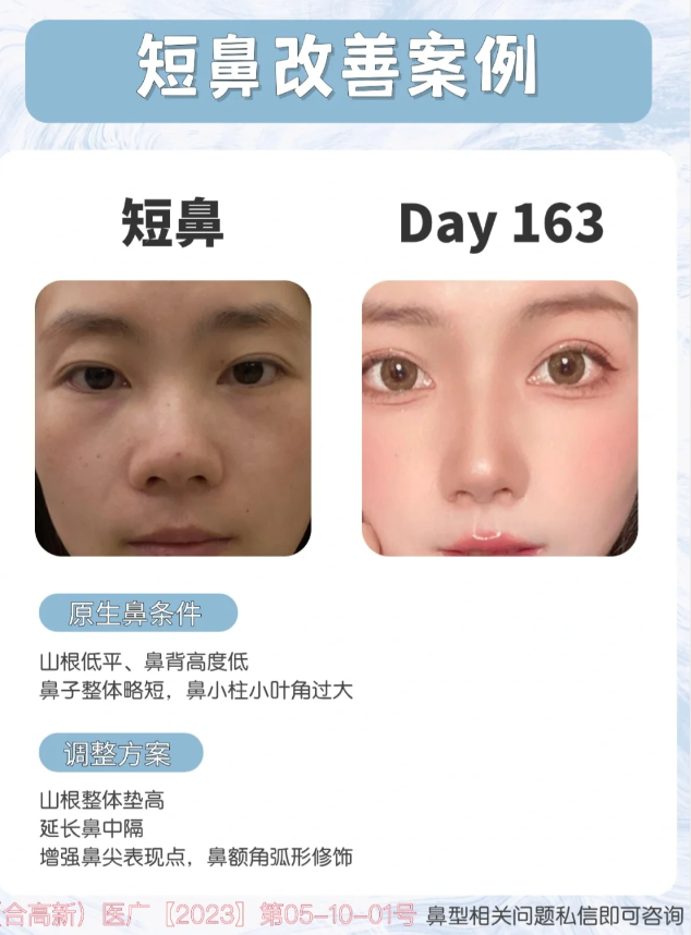 短鼻延长,精致妈生感