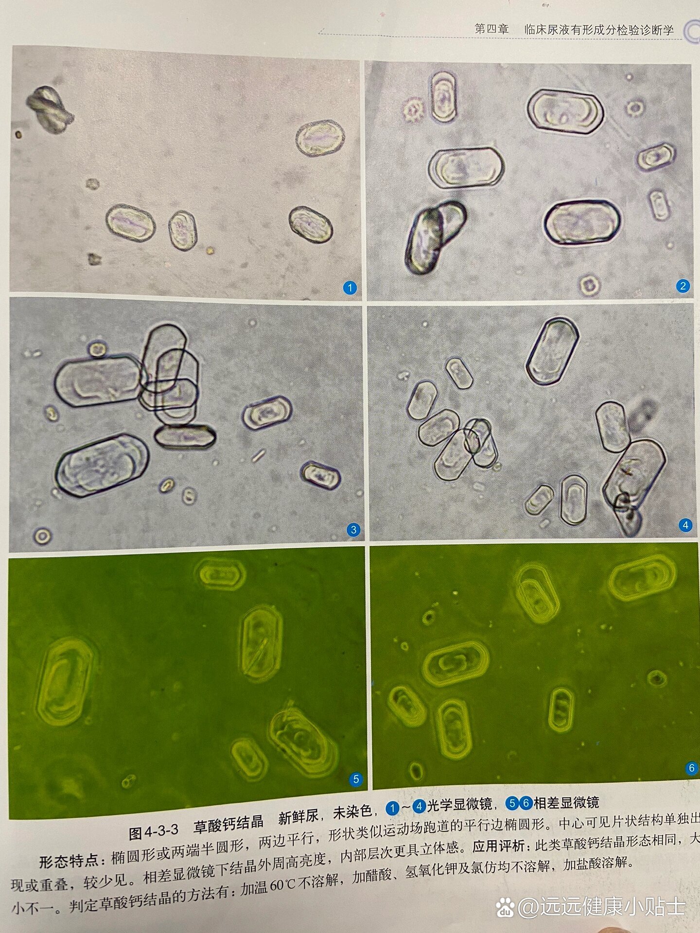 各种各样的尿结晶图谱及形态特点合集