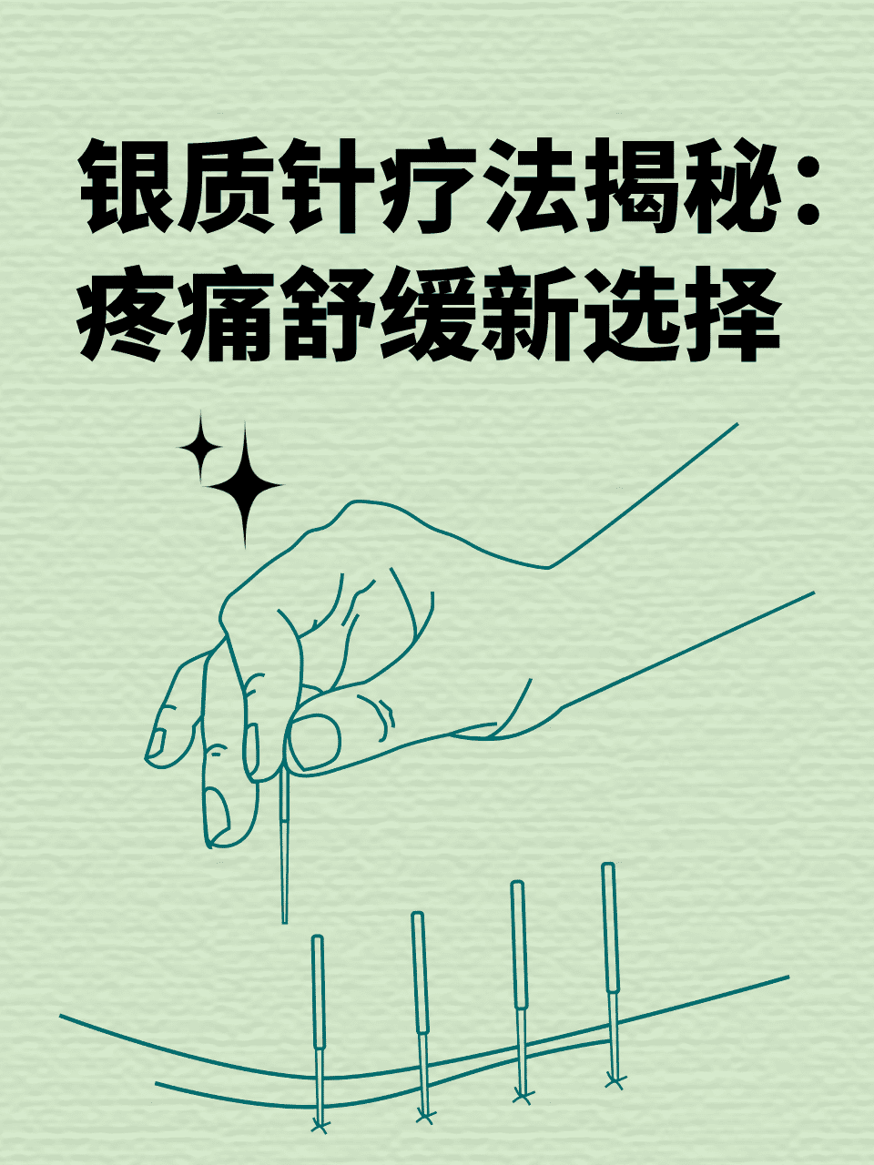 银质针疗法揭秘:疼痛舒缓新选择