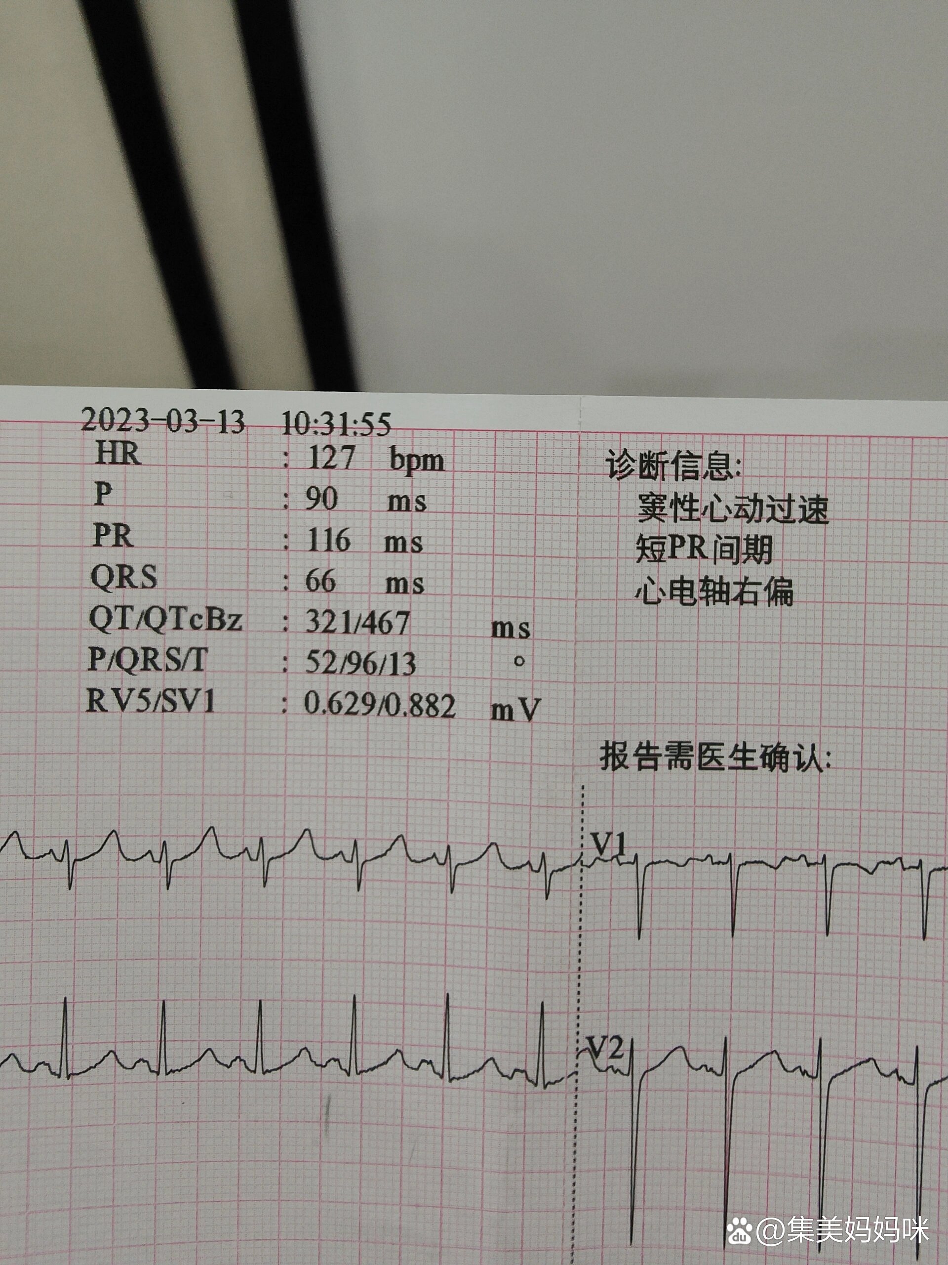 孕38周心率过快