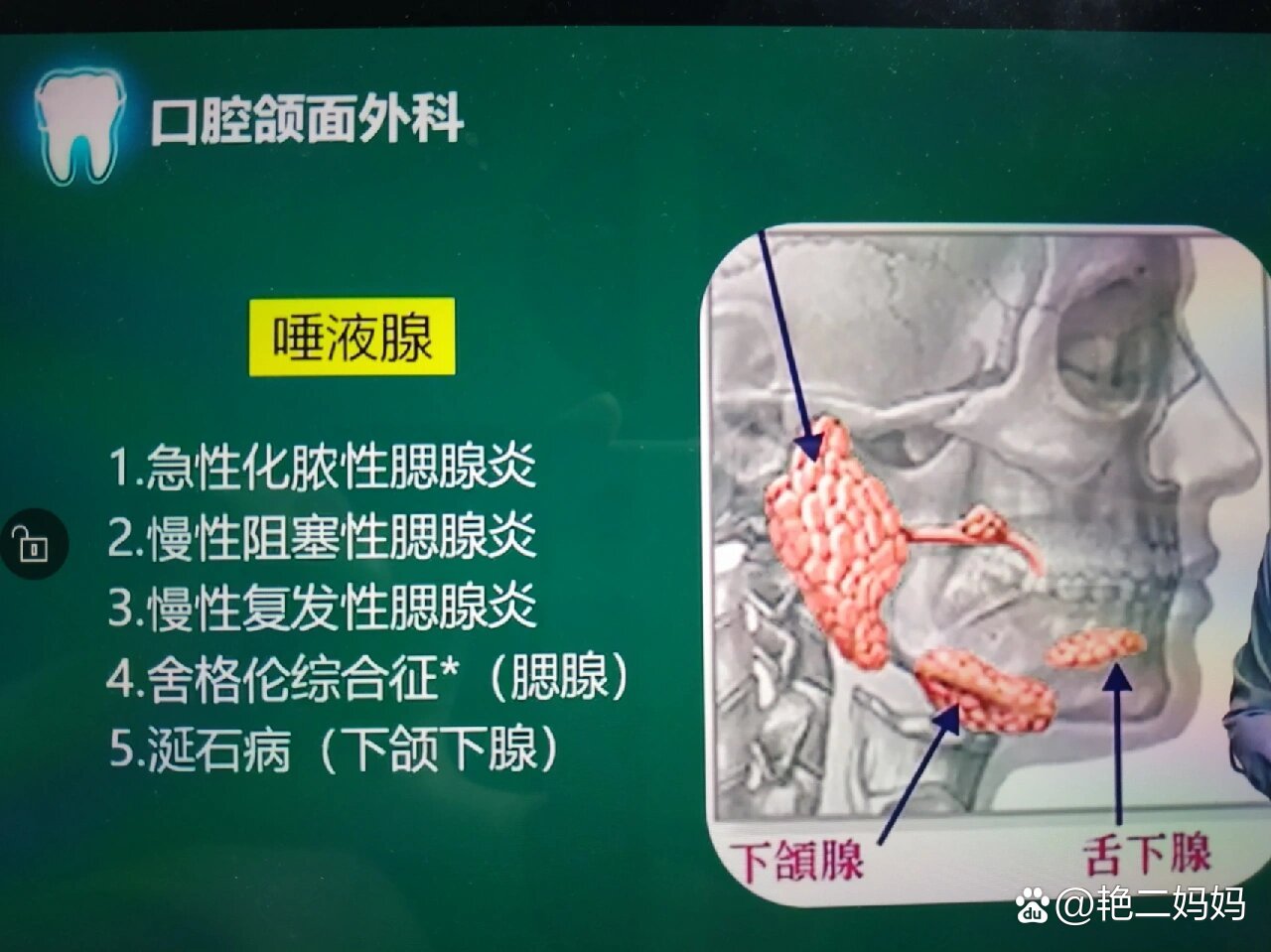 唾液腺ppt图片