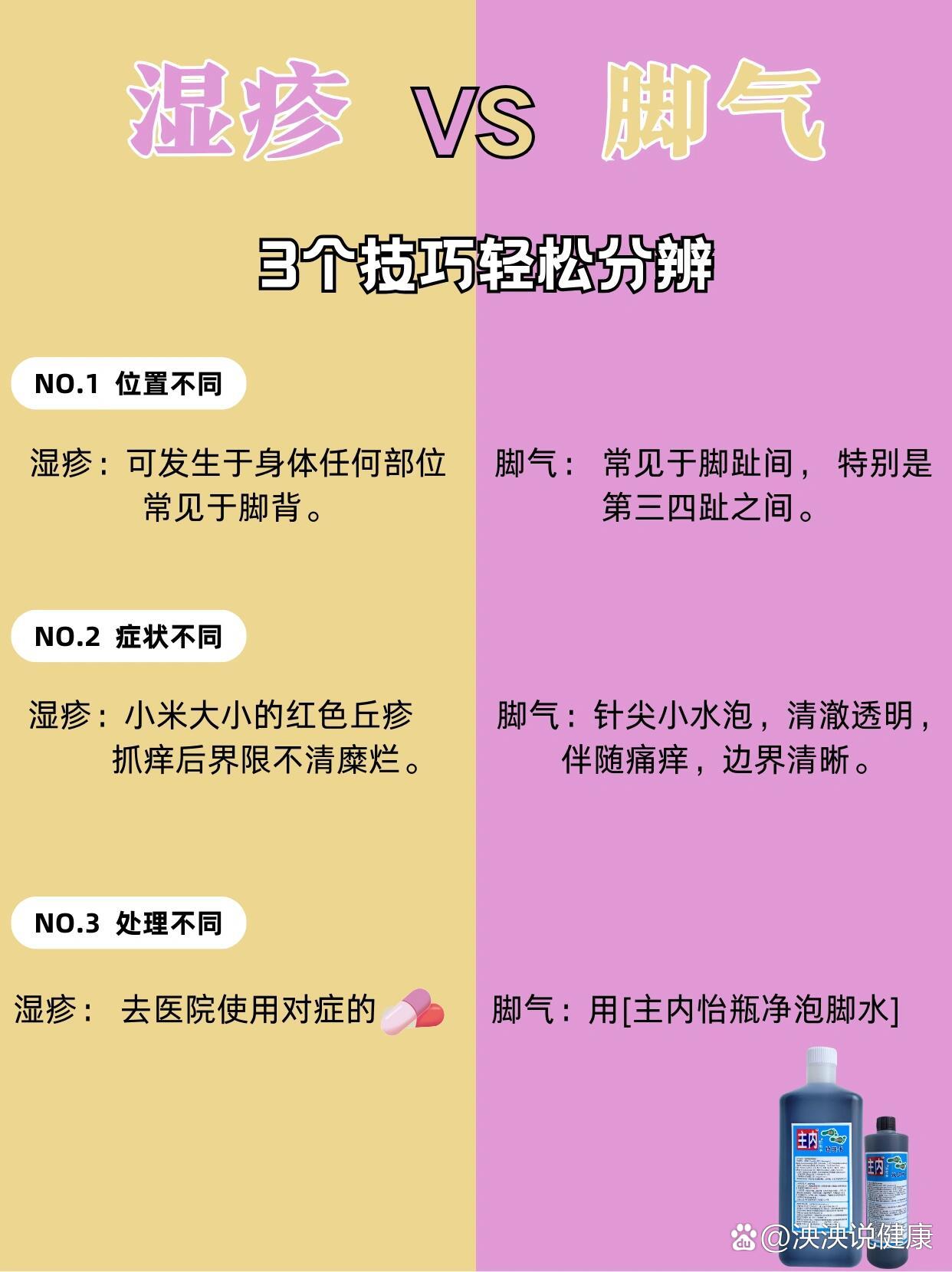 脚气与湿疹区别