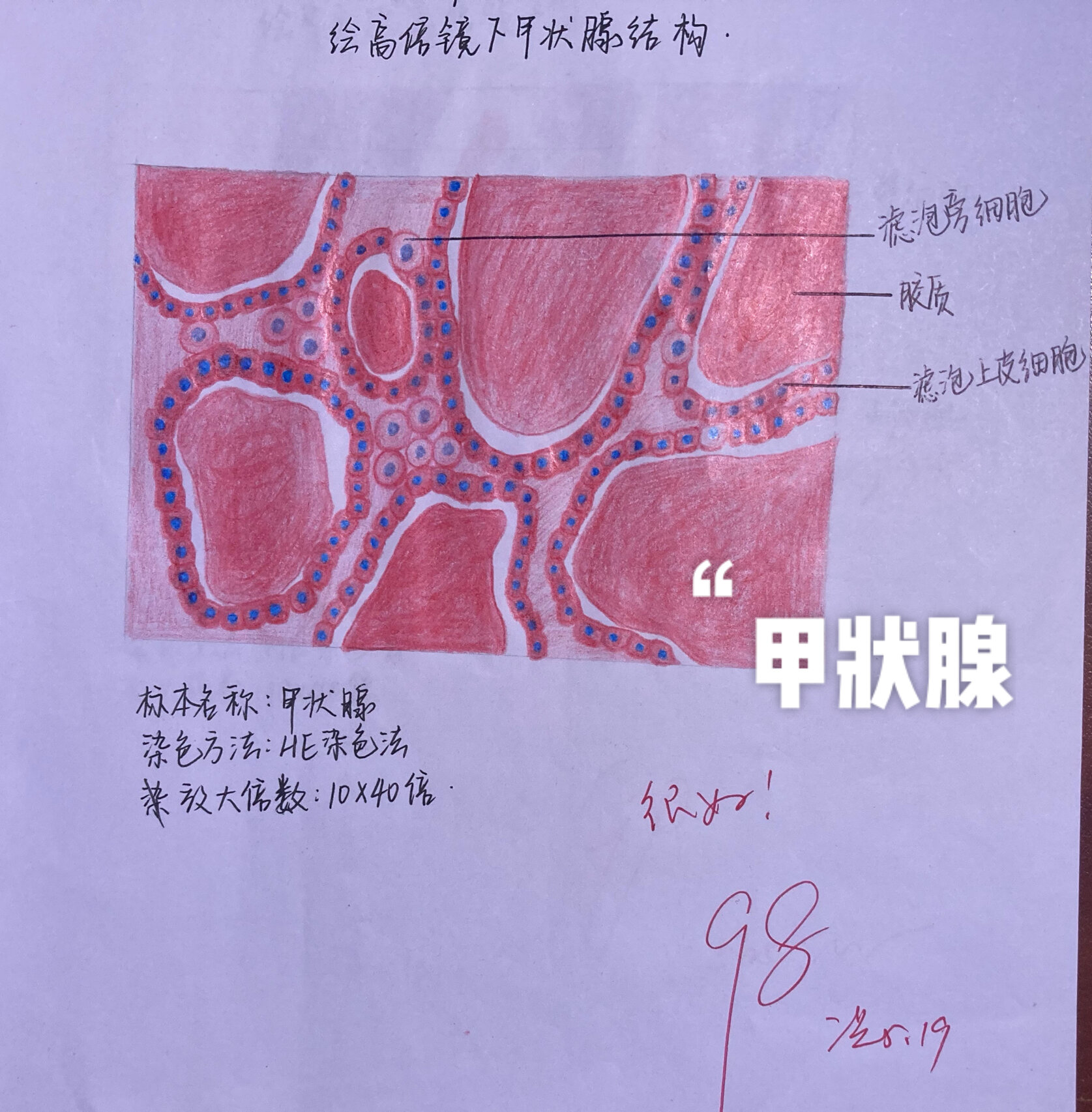 甲状腺切片手绘图图片