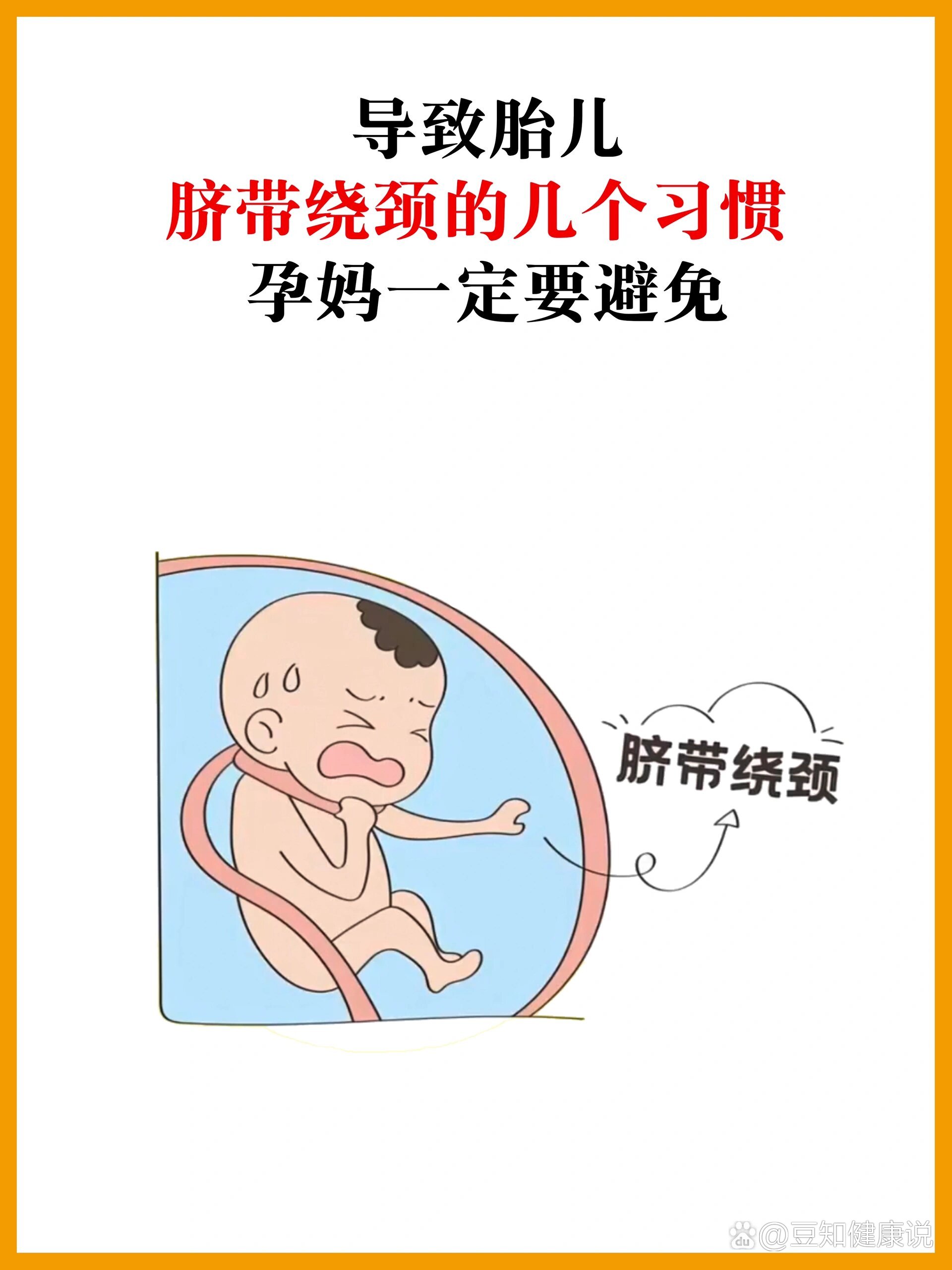 胎儿绕颈:孕妈一定要避开这几个习惯
