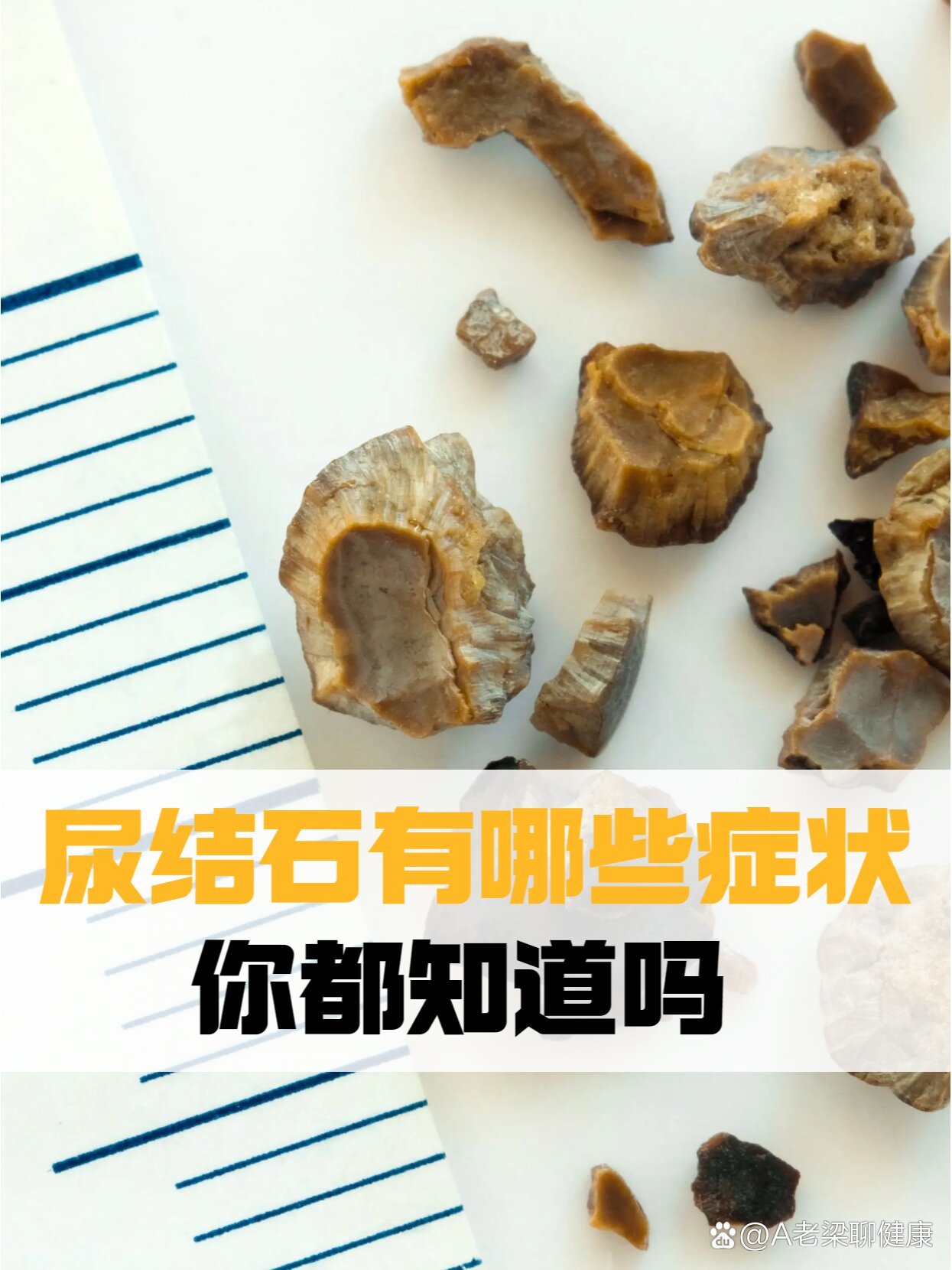 尿结石有哪些症状表现图片