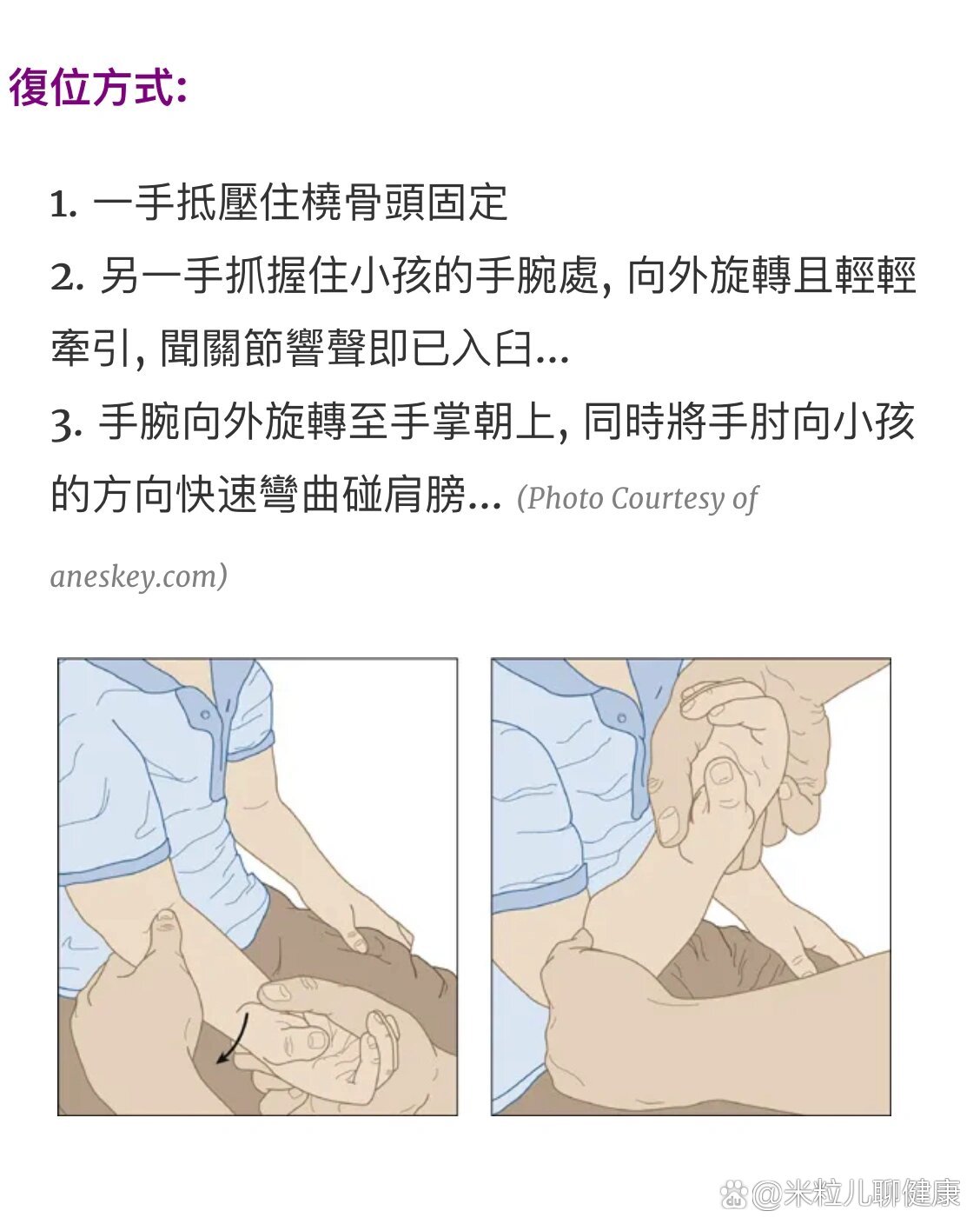 宝宝手腕脱臼复位图解图片