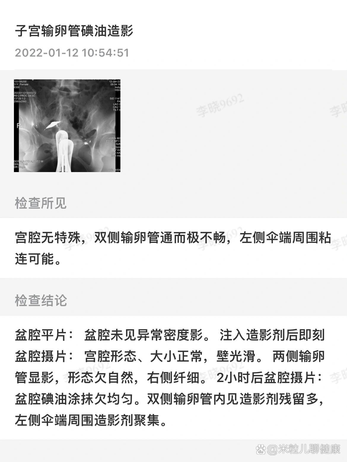 输卵管通而极不畅