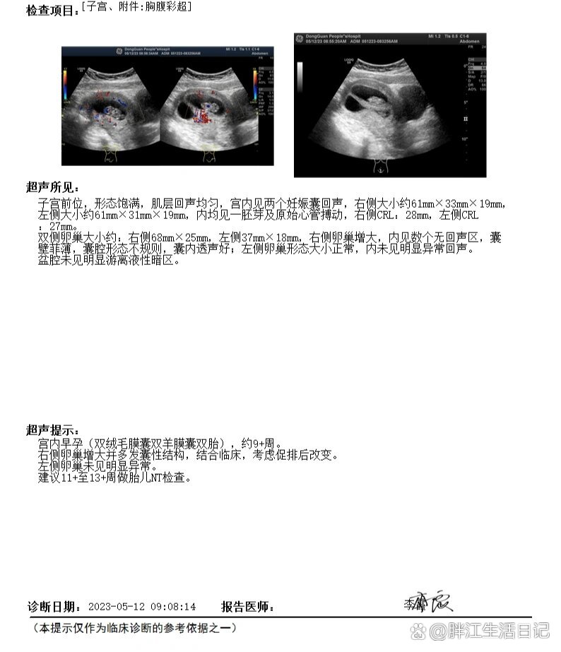 胎盘图片超声图片