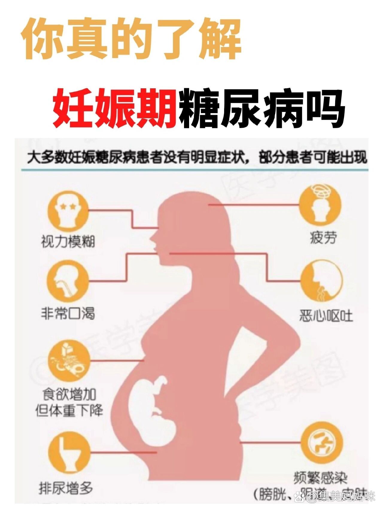 妊娠期糖尿病