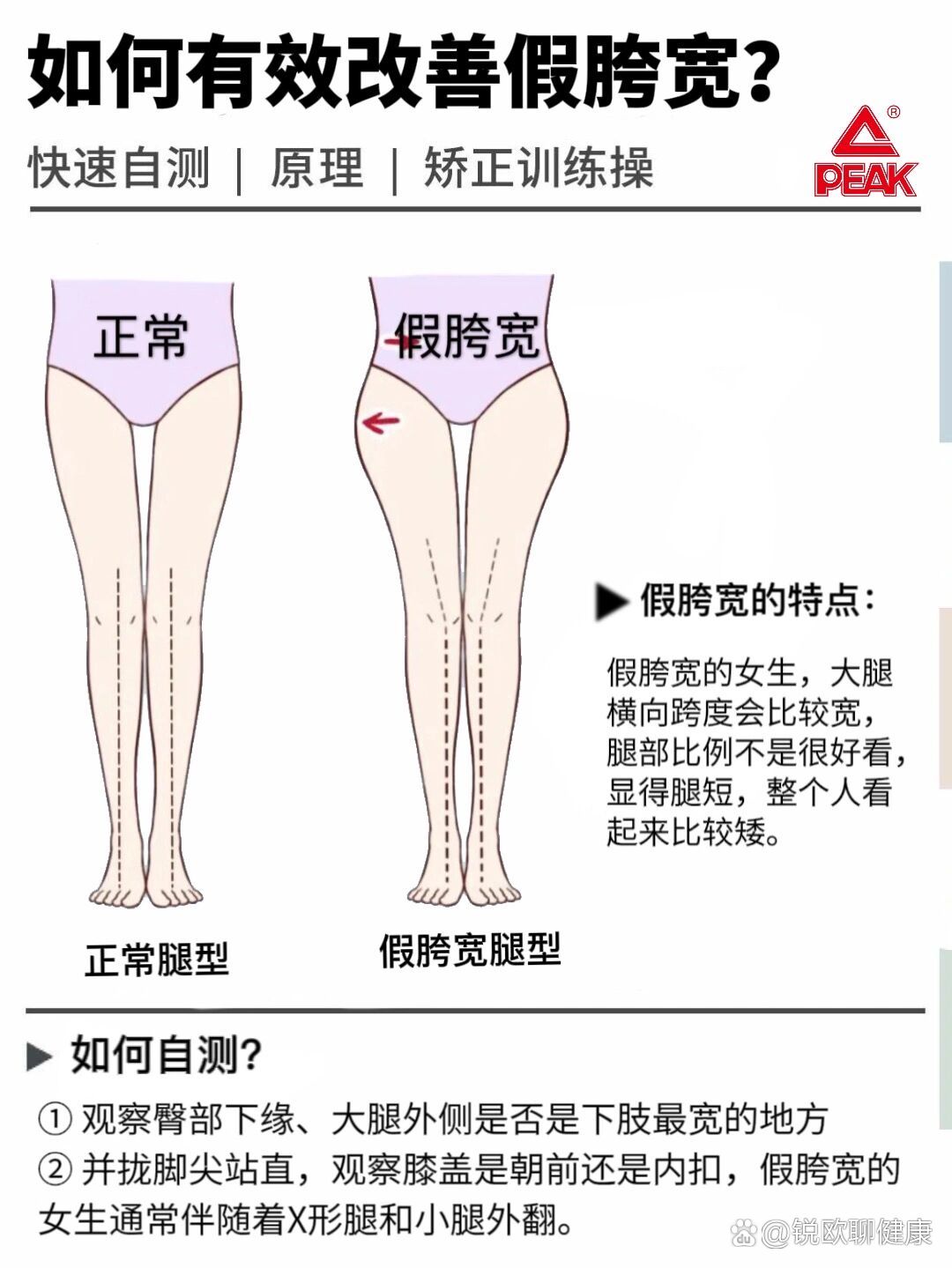 如何矫正假胯宽图解图片