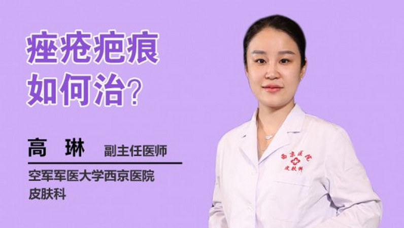 痤疮疤痕如何治?