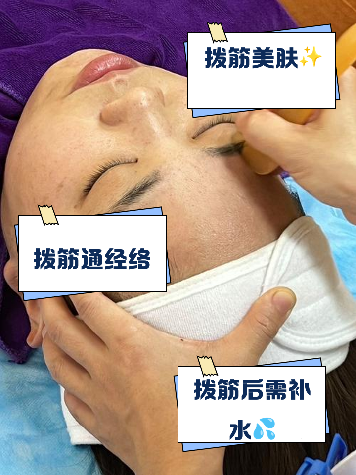脸上拨筋有什么好处和坏处