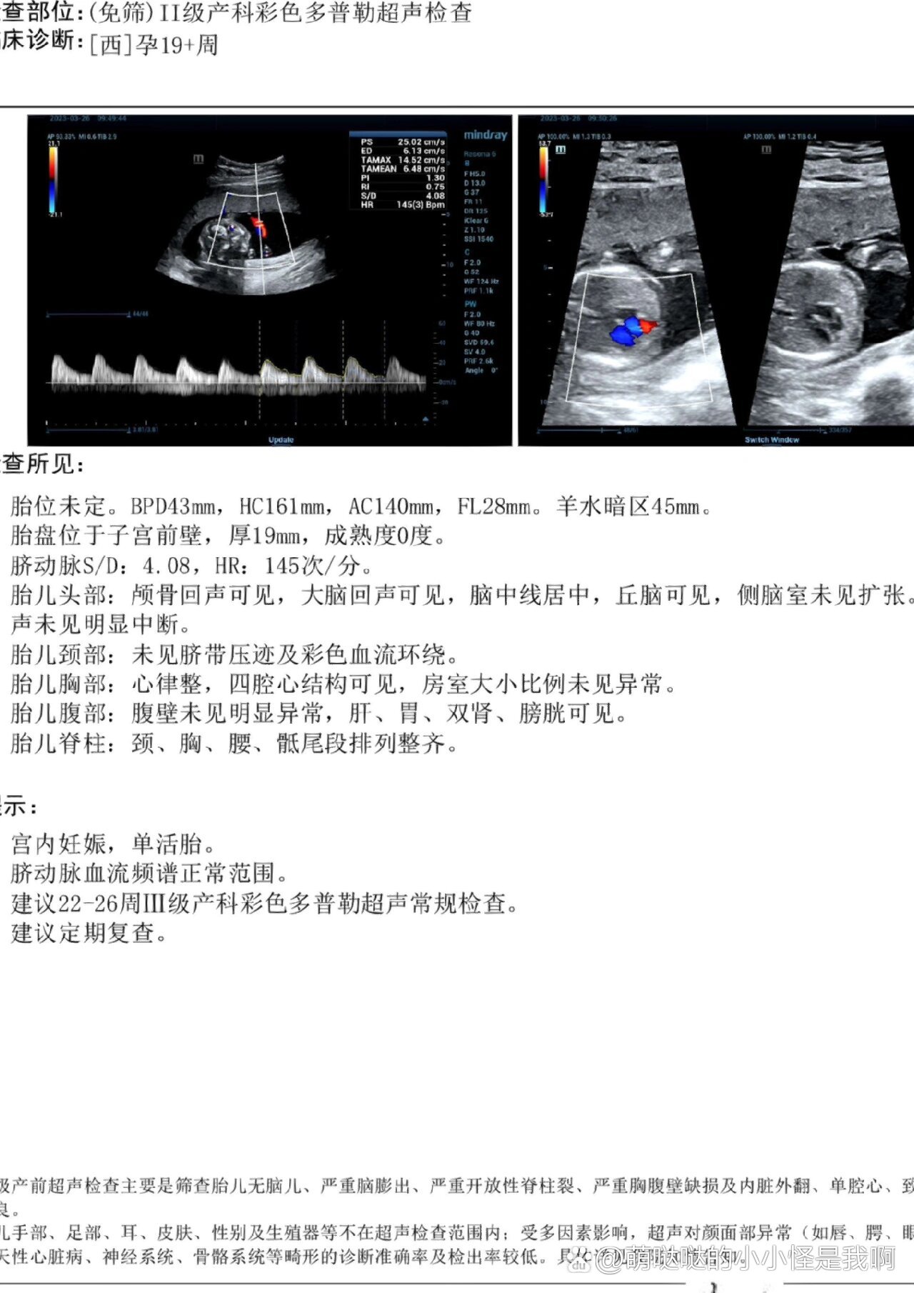 怀孕19周胎儿彩超图图片