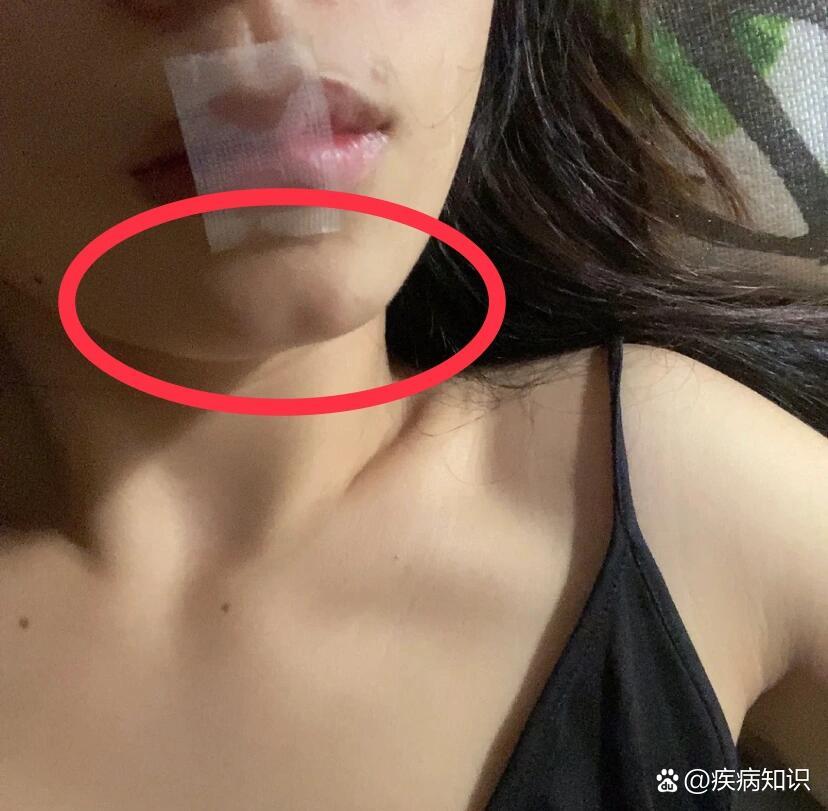 垫下巴失败的图片图片