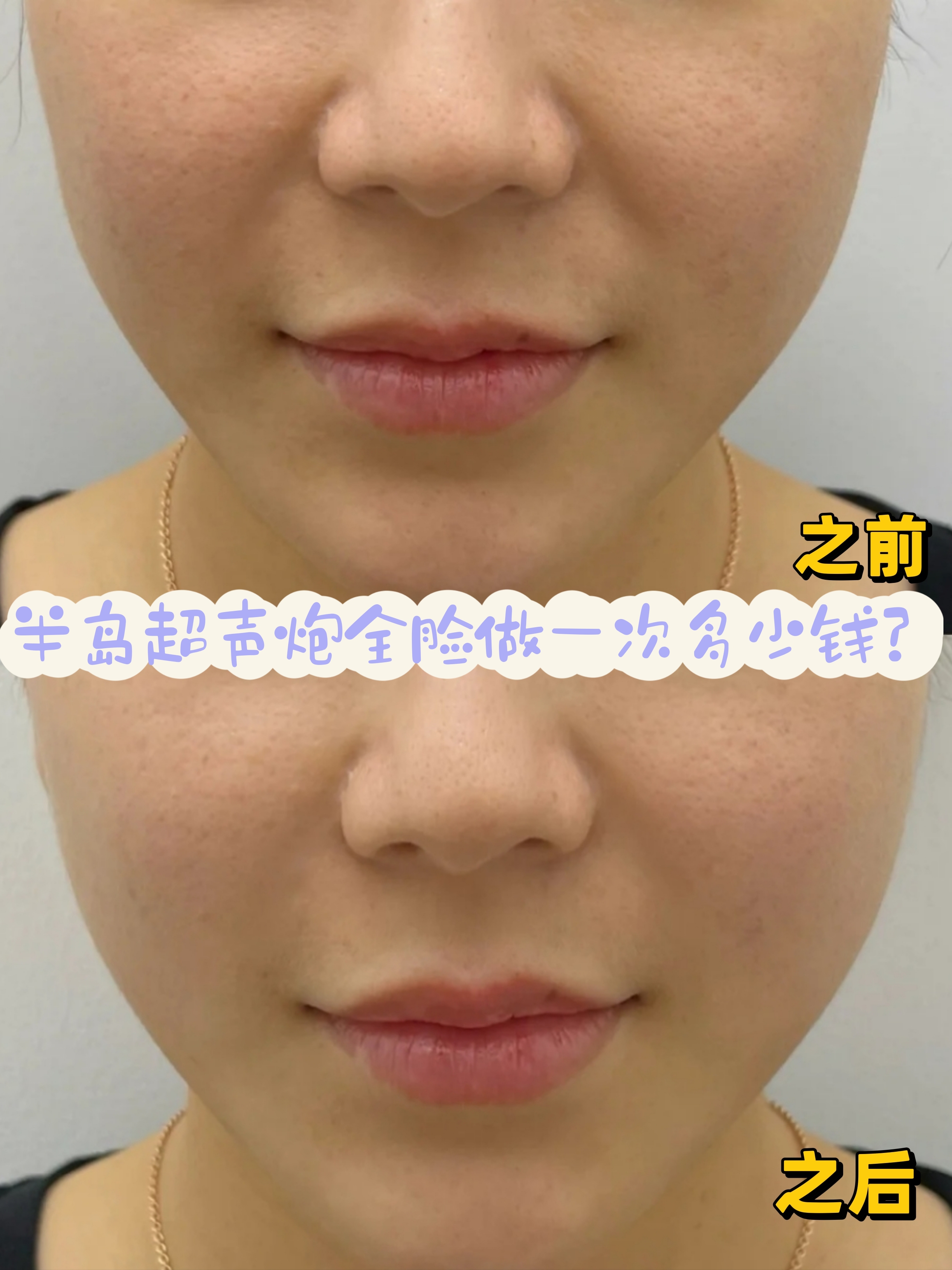 br今天我们就来聊一聊～br发数我做的是2m