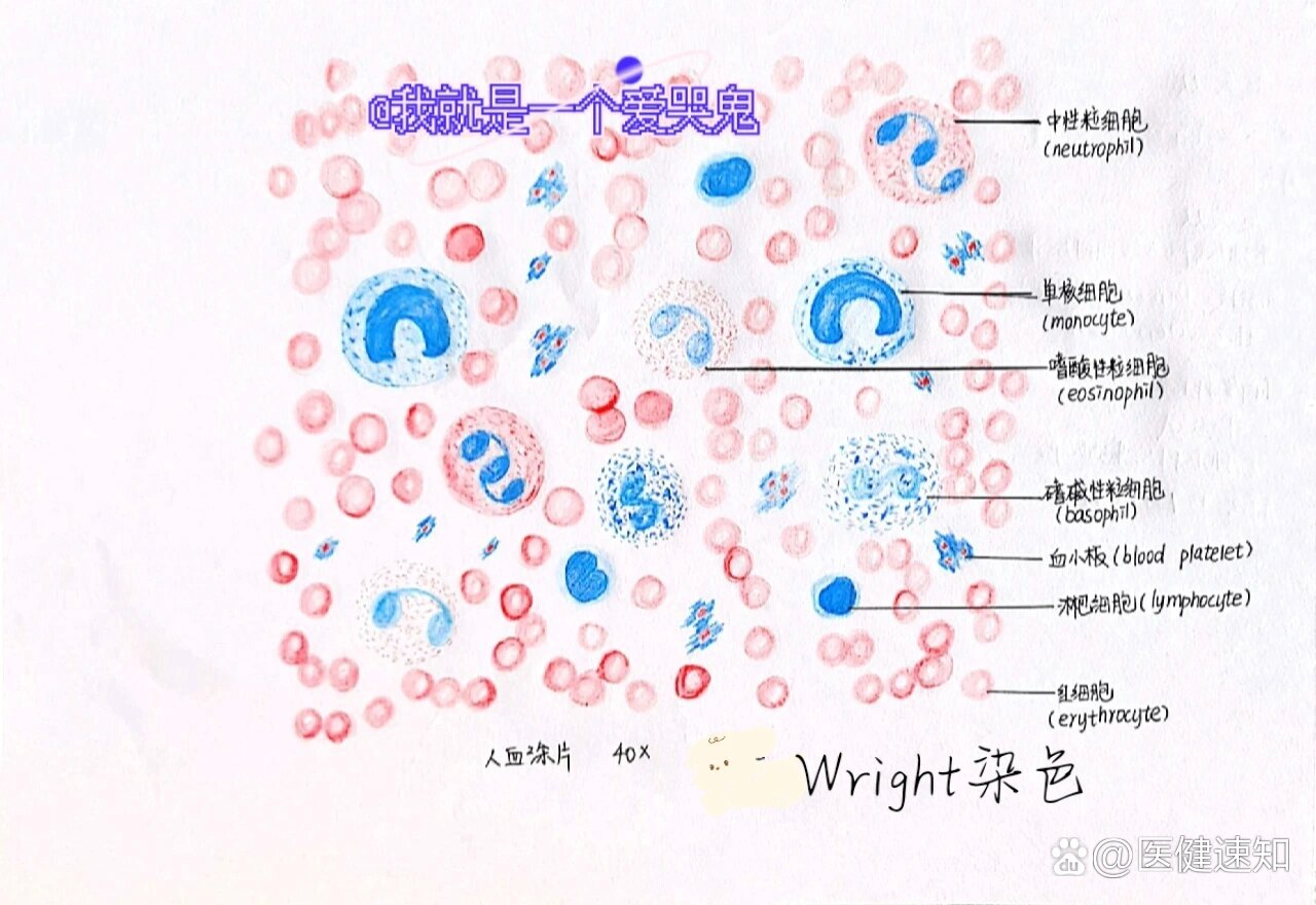 人血涂片