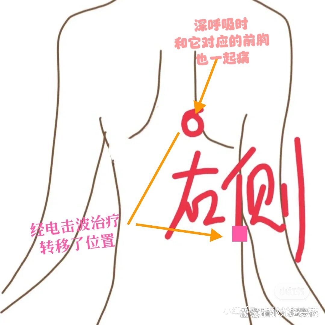 肩胛骨疼痛后背疼痛