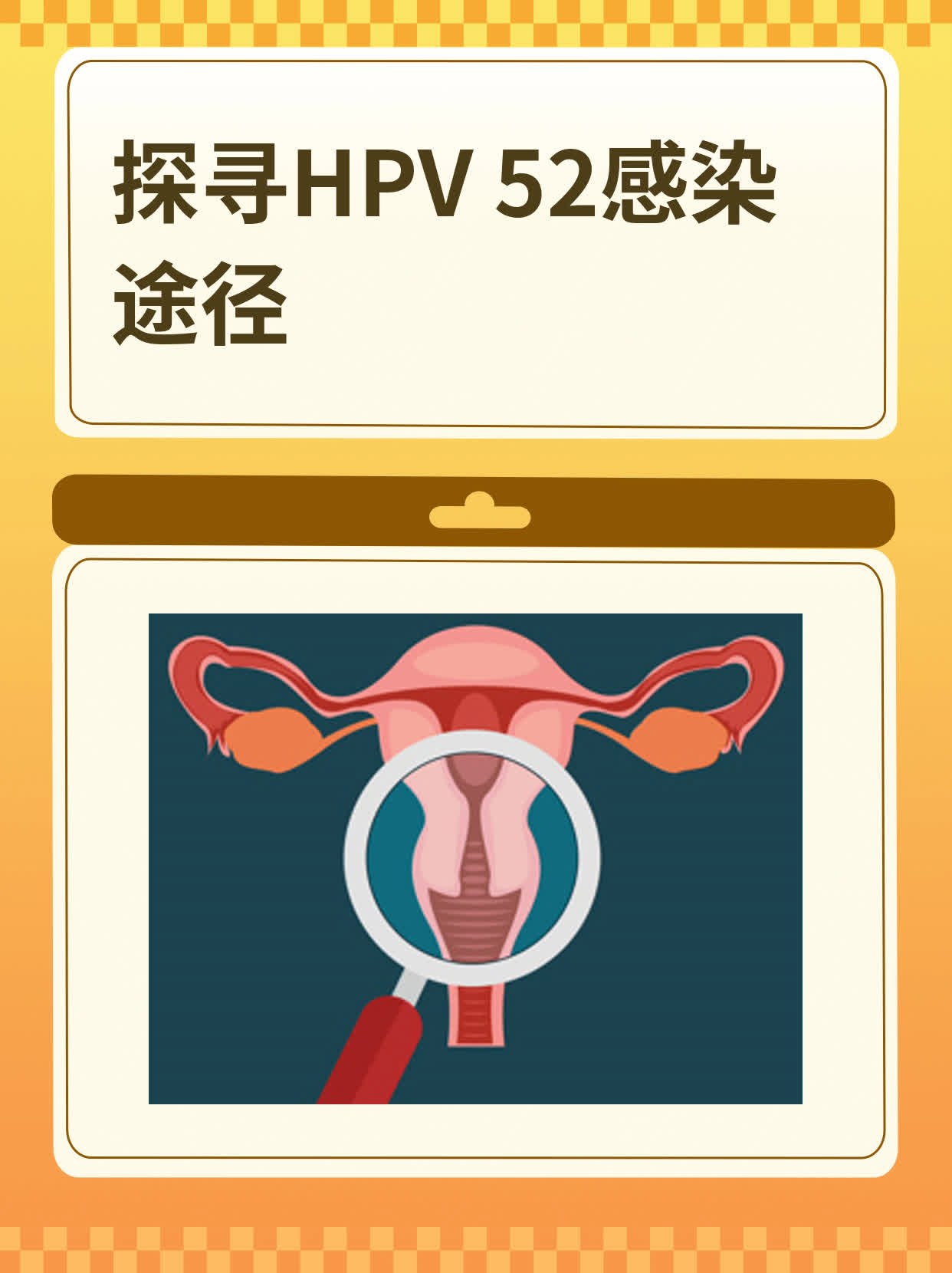 女人感染hpv52图片图片