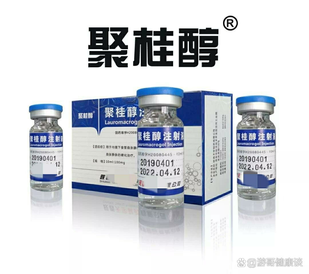 聚桂醇硬化剂局部注射治疗的机理及优势